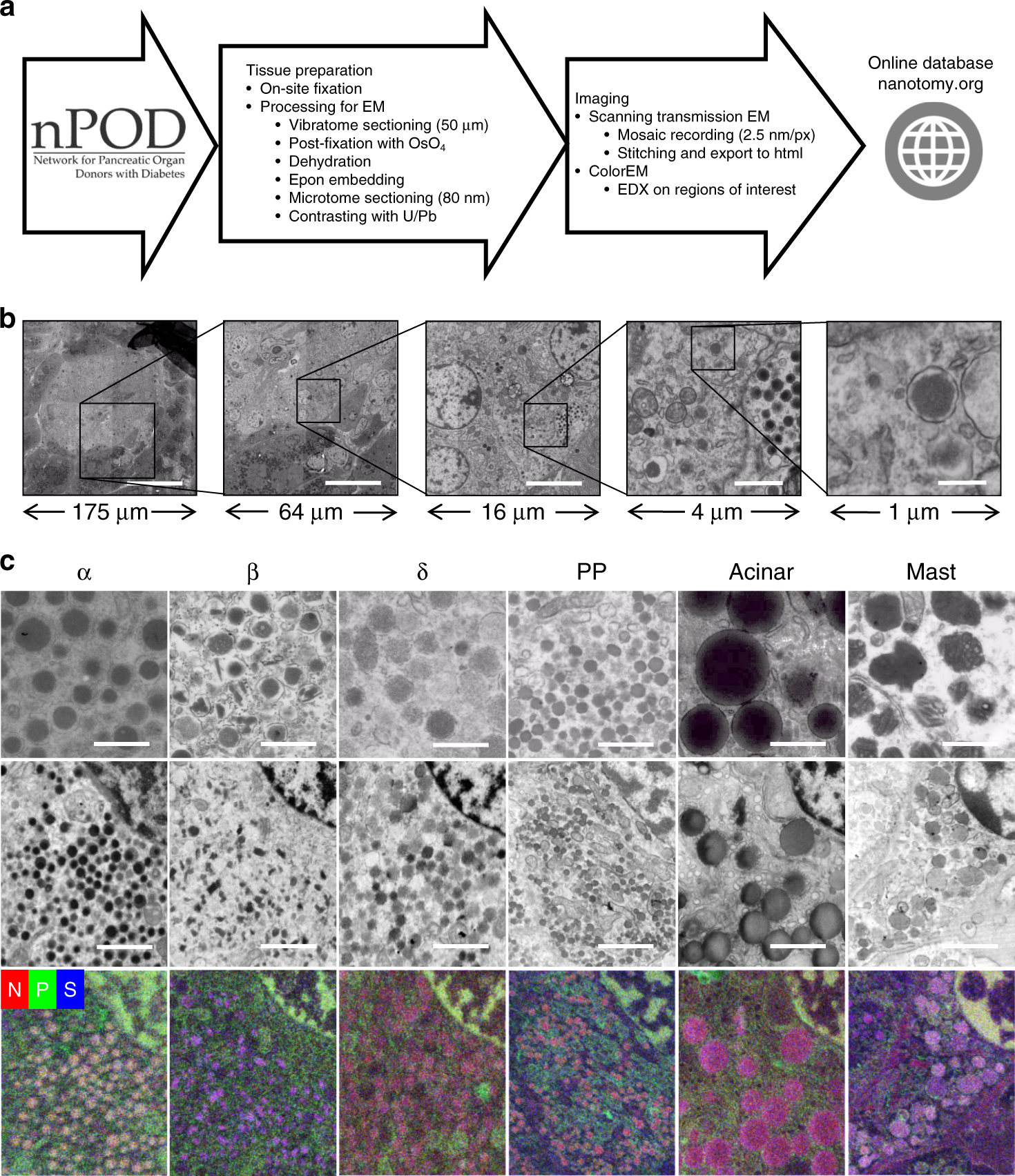 Large Scale Electron Microscopy Database For Human Type 1 Diabetes Nature Communications Large Scale Electron Microscopy Database For Human Type 1 Diabetes Nature Communications
