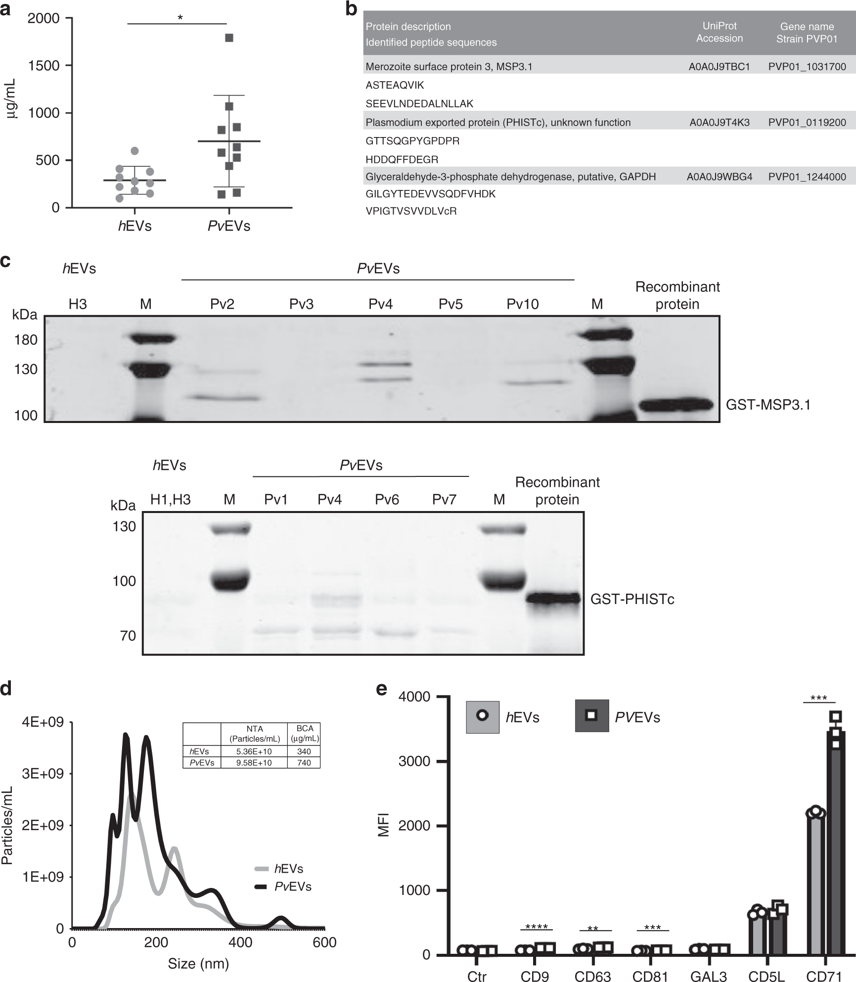 Fig. 1: Characterization of plasma-derived extracellular vesicles from P. vivax patients.
