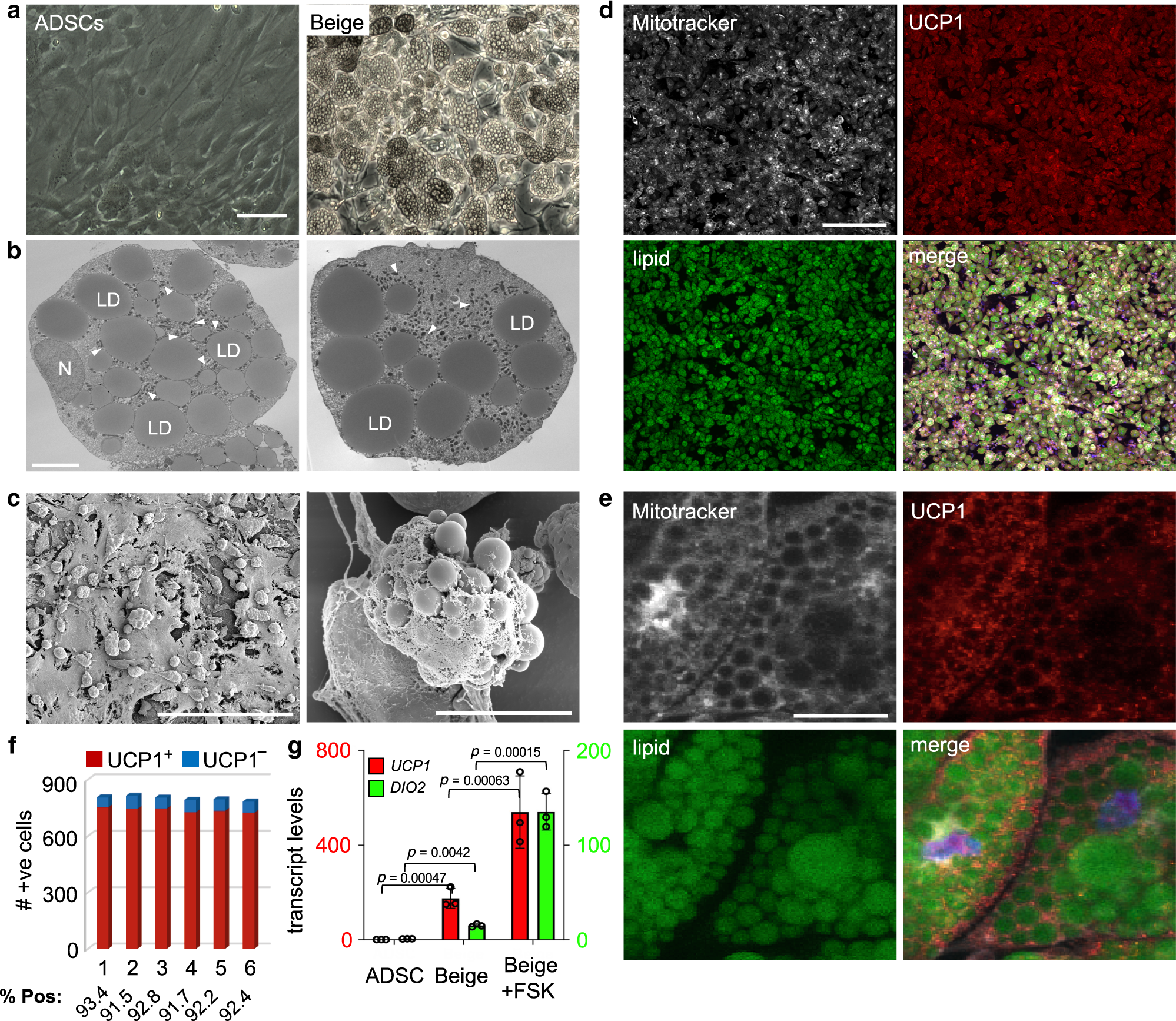Human Beige Adipocytes For Discovery And Cell Therapy In Beige Adipocytes For Discovery