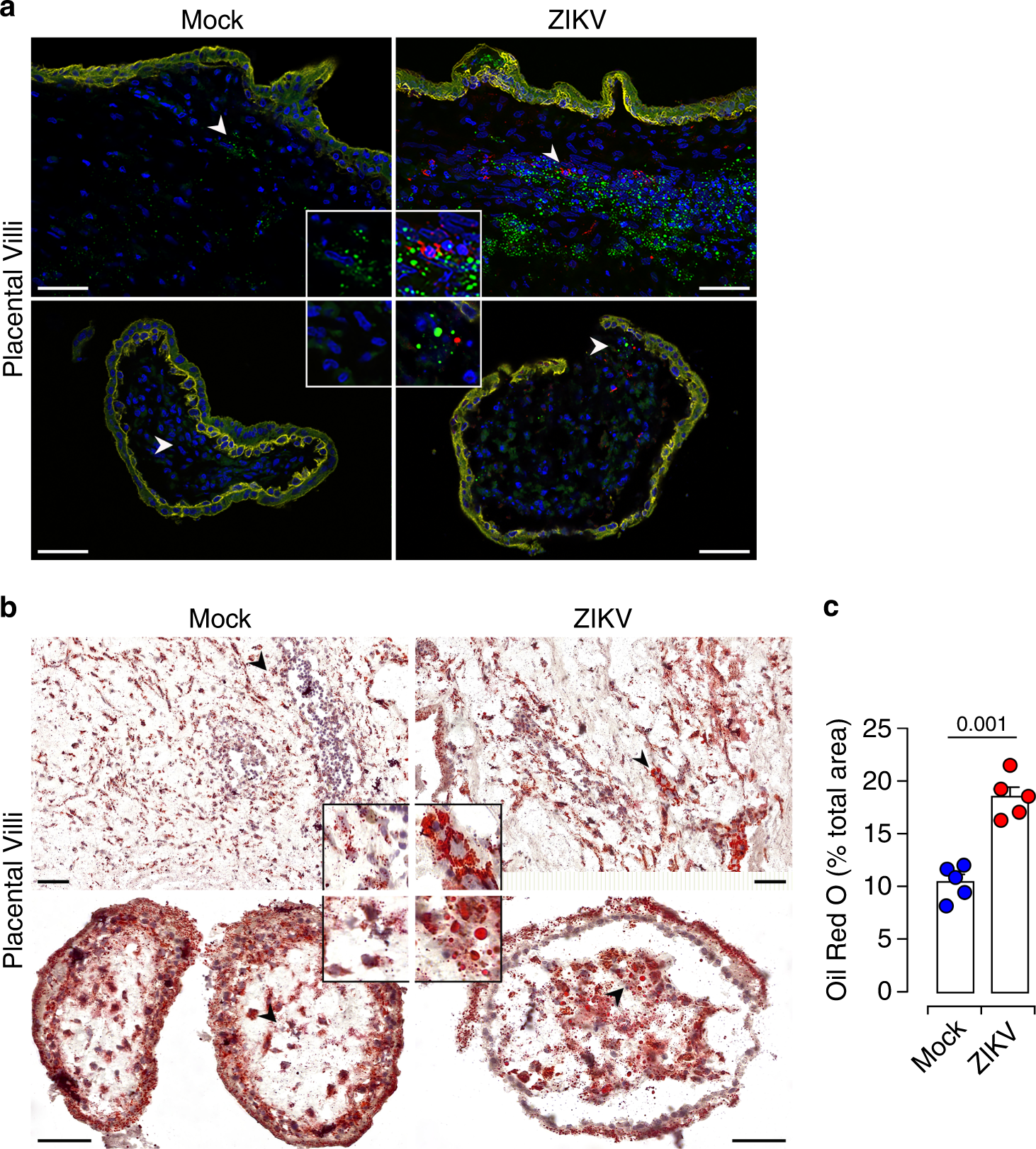 Fig. 3: Accumulation of LDs in ZIKV-infected placenta.