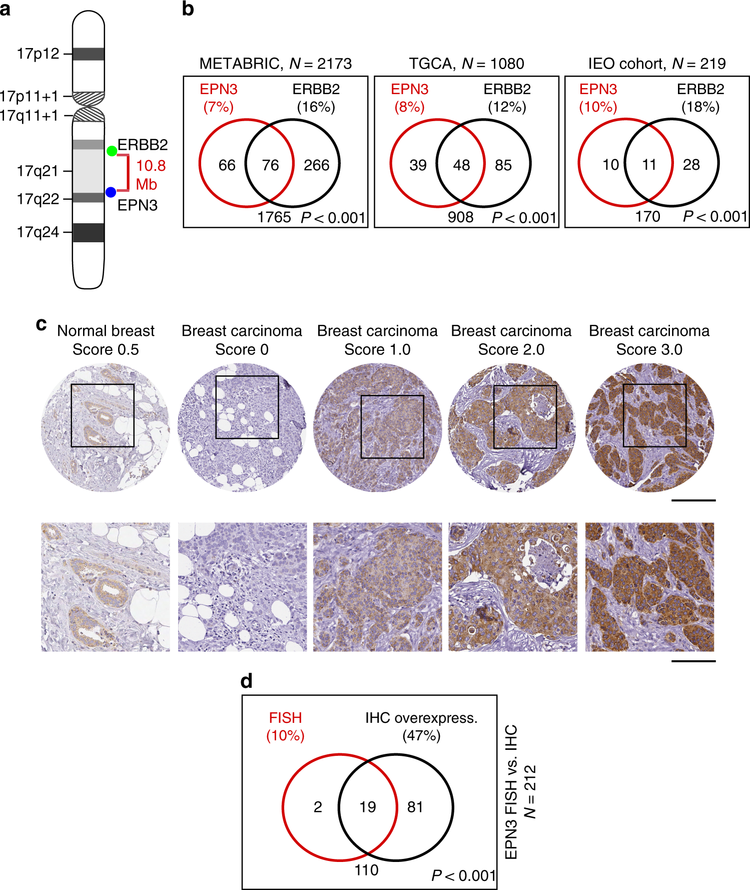 A self-sustaining endocytic-based loop promotes breast cancer plasticity  leading to aggressiveness and pro-metastatic behavior | Nature  Communications