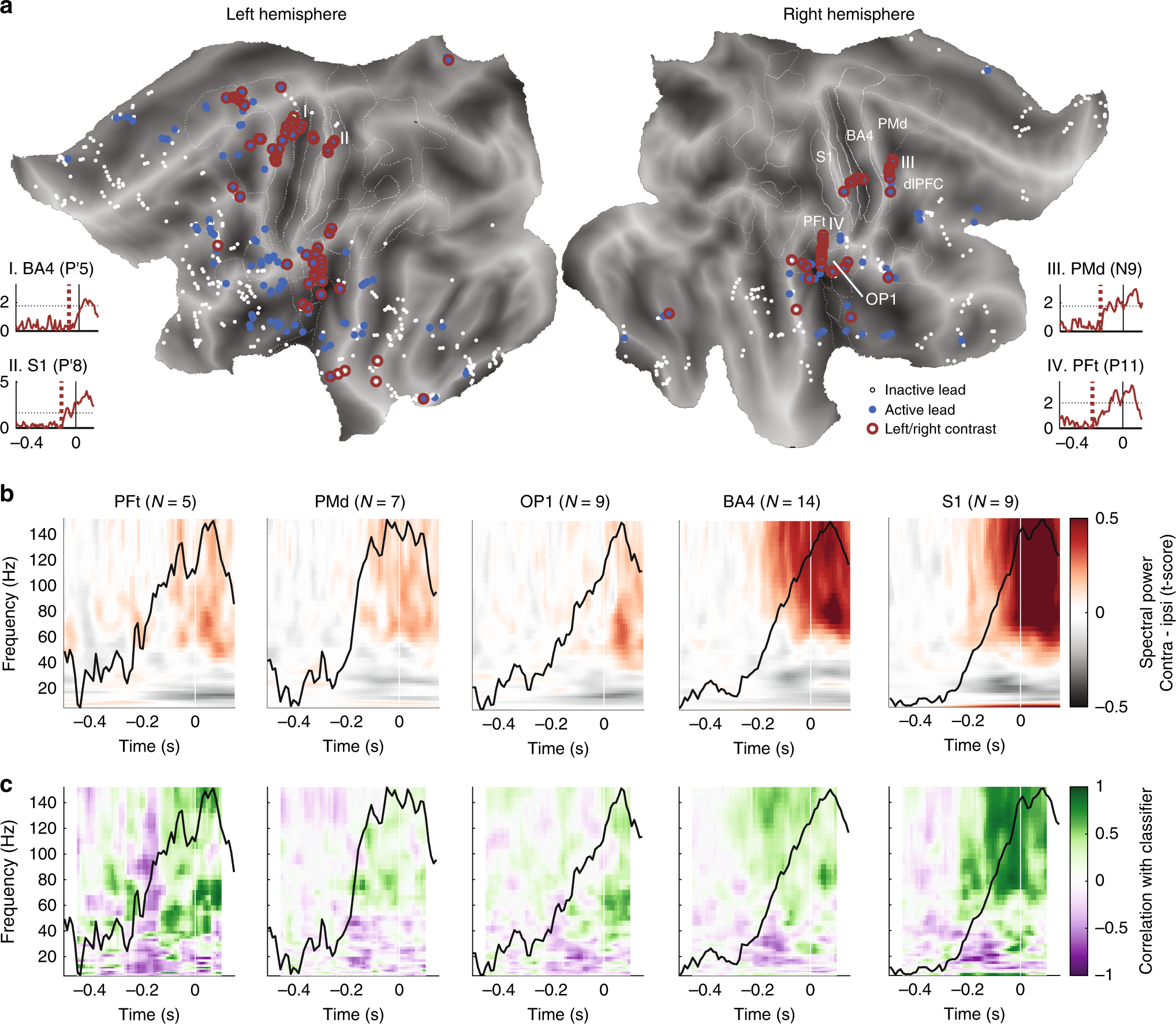 Fig. 2: LDA classifier identified leads that carry decision information.