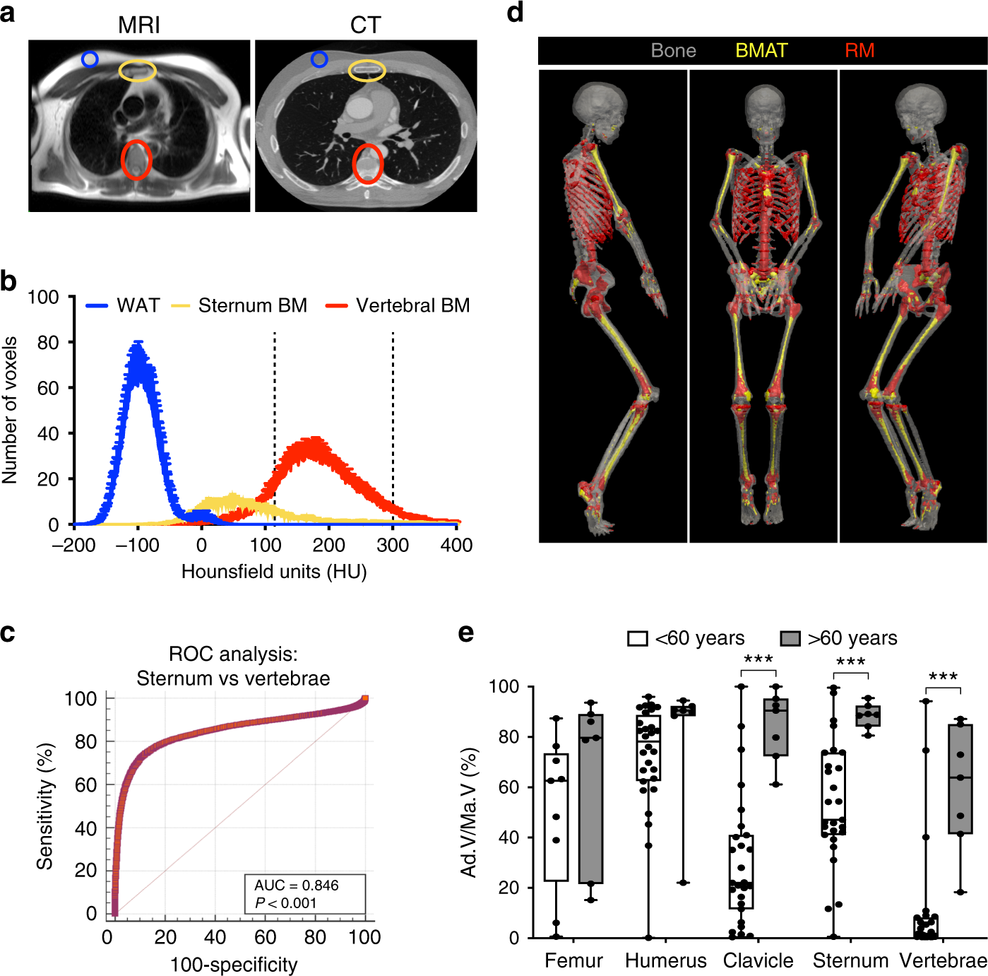 Fig. 6: CT-based identification of BMAT in humans.