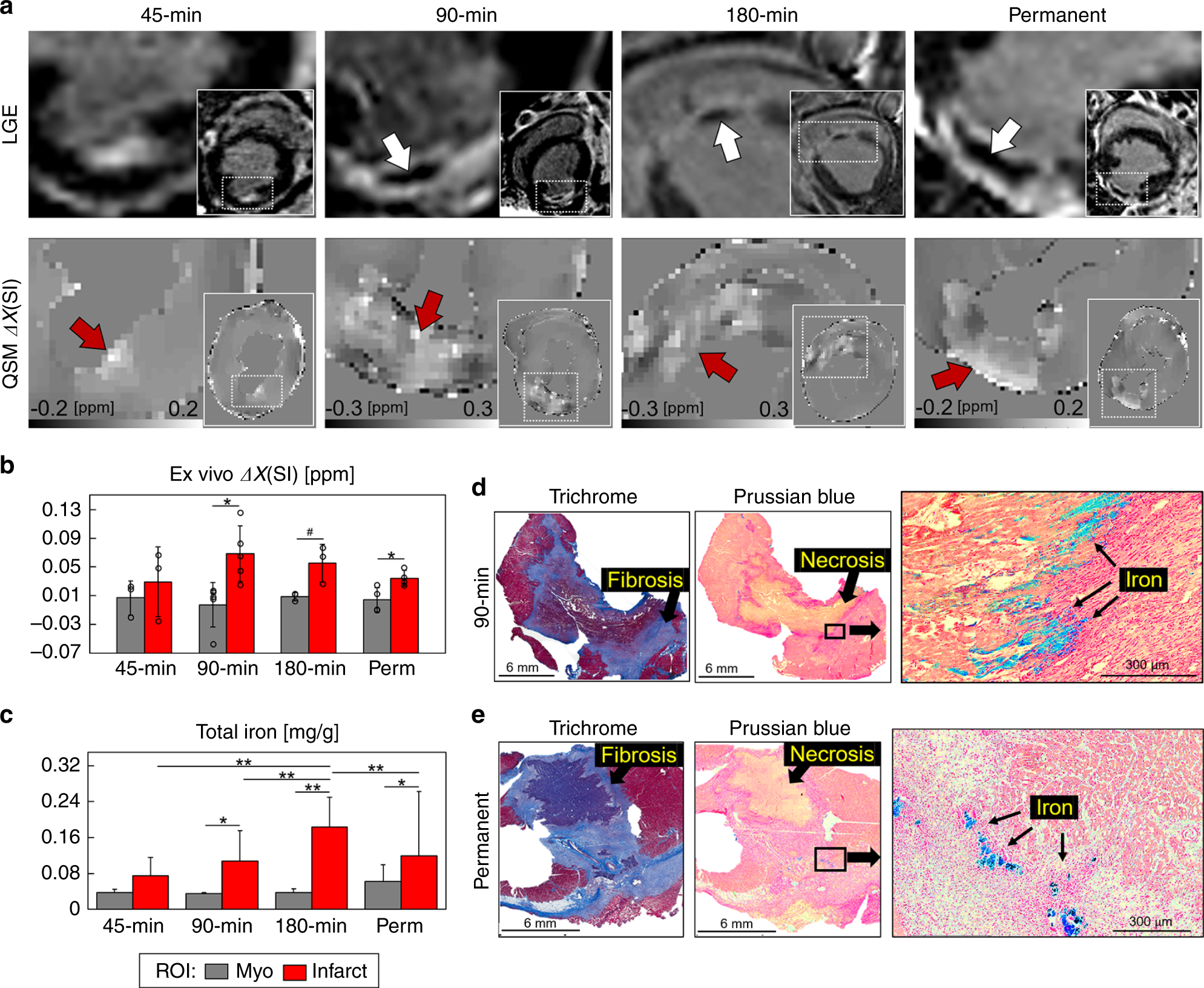 Iron imaging in myocardial infarction reperfusion injury | Nature  Communications