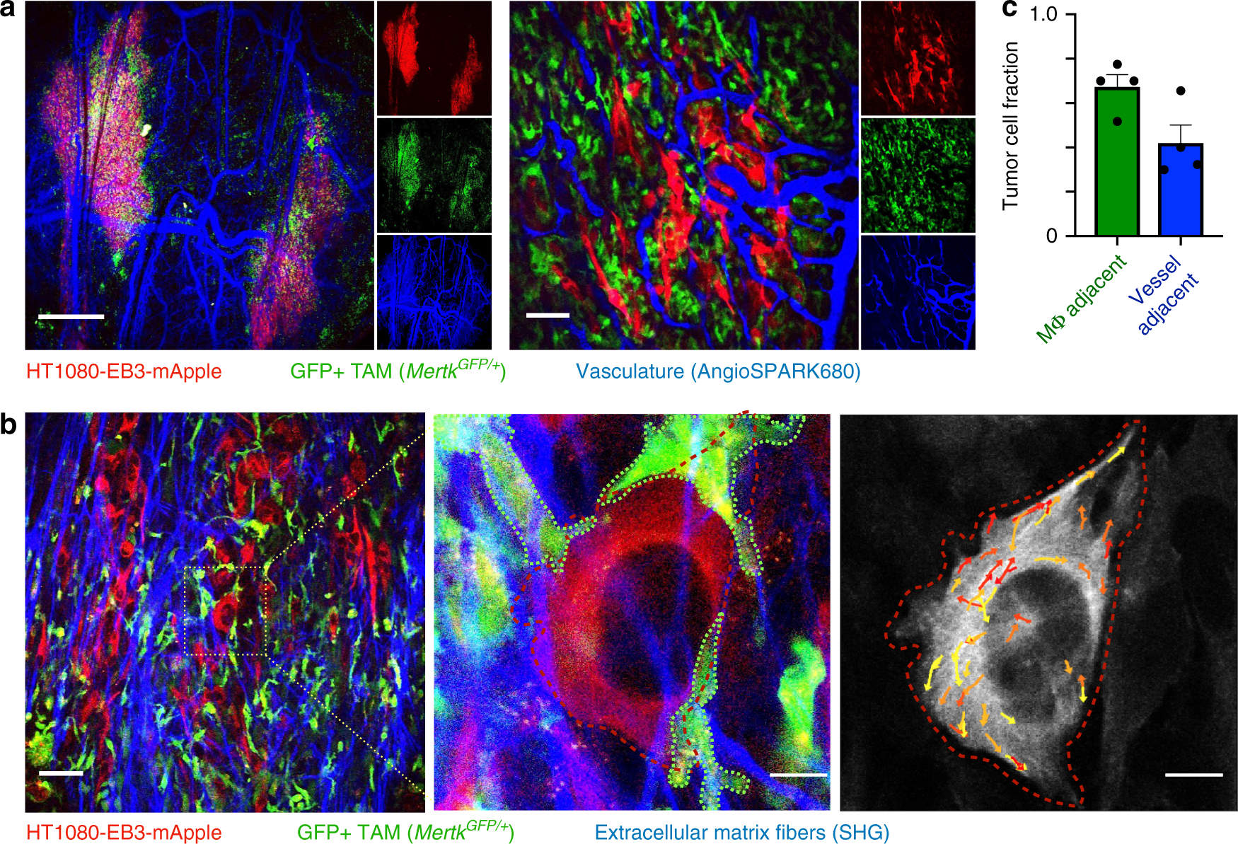 Fig. 3: TAMs frequently neighbor tumor cells near vasculature and fibrillar extracellular matrix.