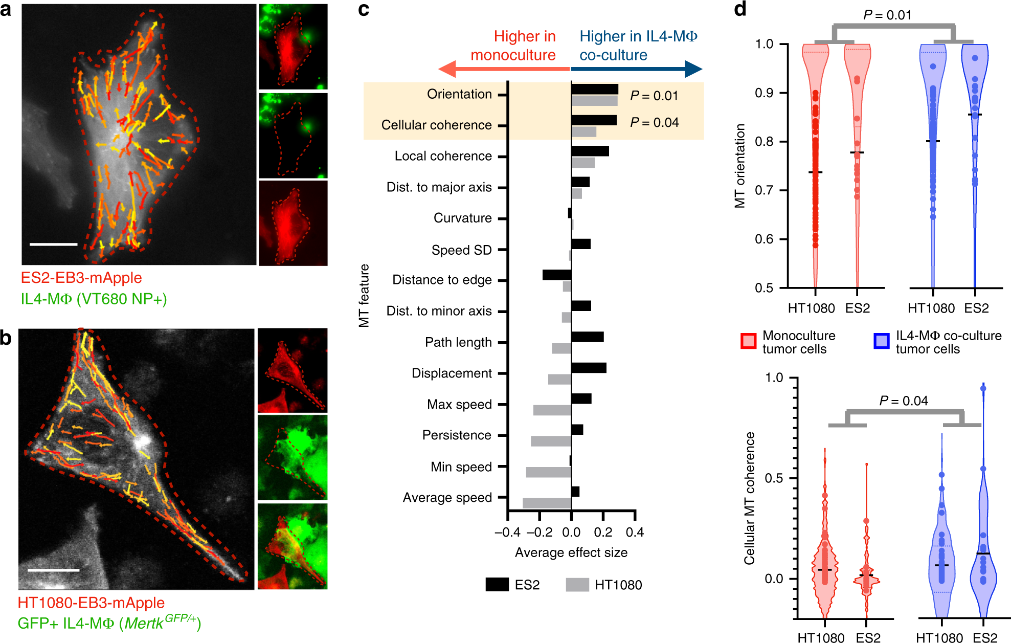 Fig. 4: IL4-polarized MΦ promote coherent MT alignment in neighboring tumor cells.