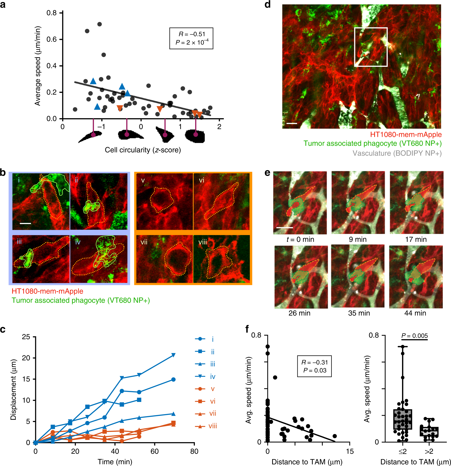 Fig. 7: TAMs associate with pseudopod-like protrusions in migrating cancer cells.