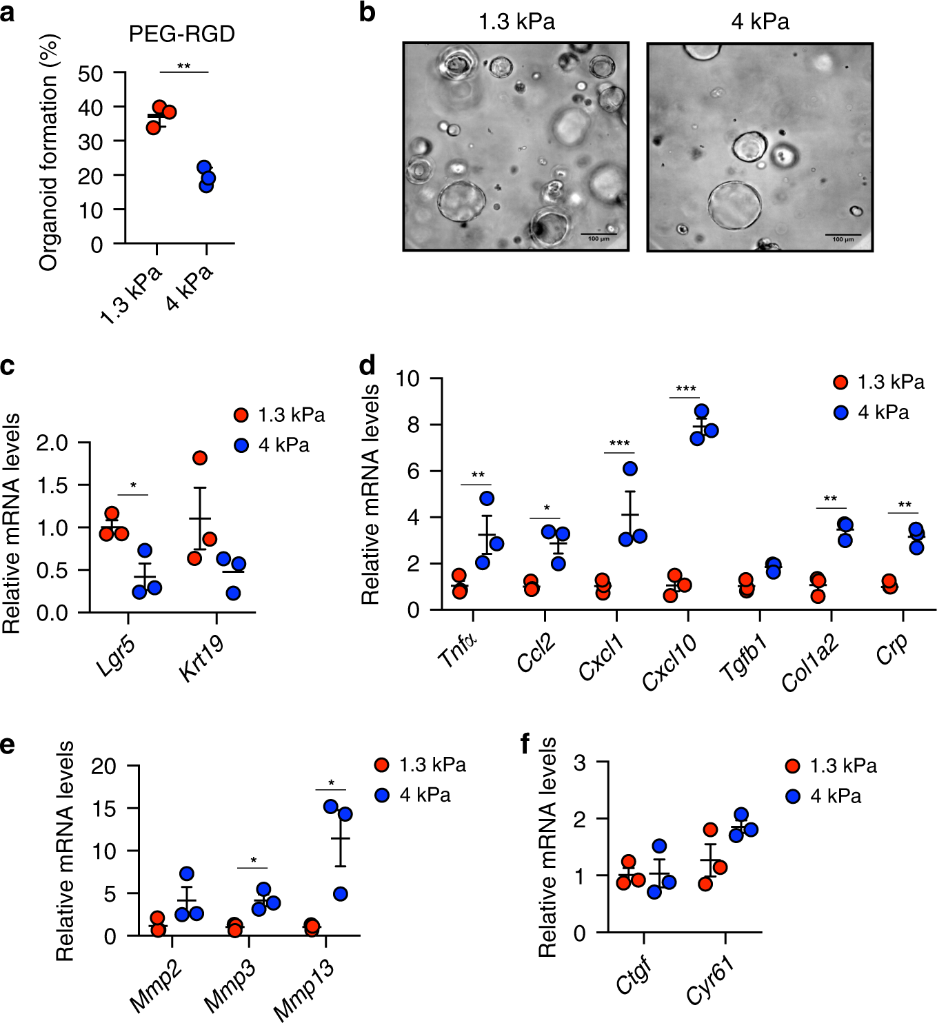 Fig. 4: Hydrogels mimicking the stiffness of native fibrotic liver affect the growth of liver organoids and promote a stress response.