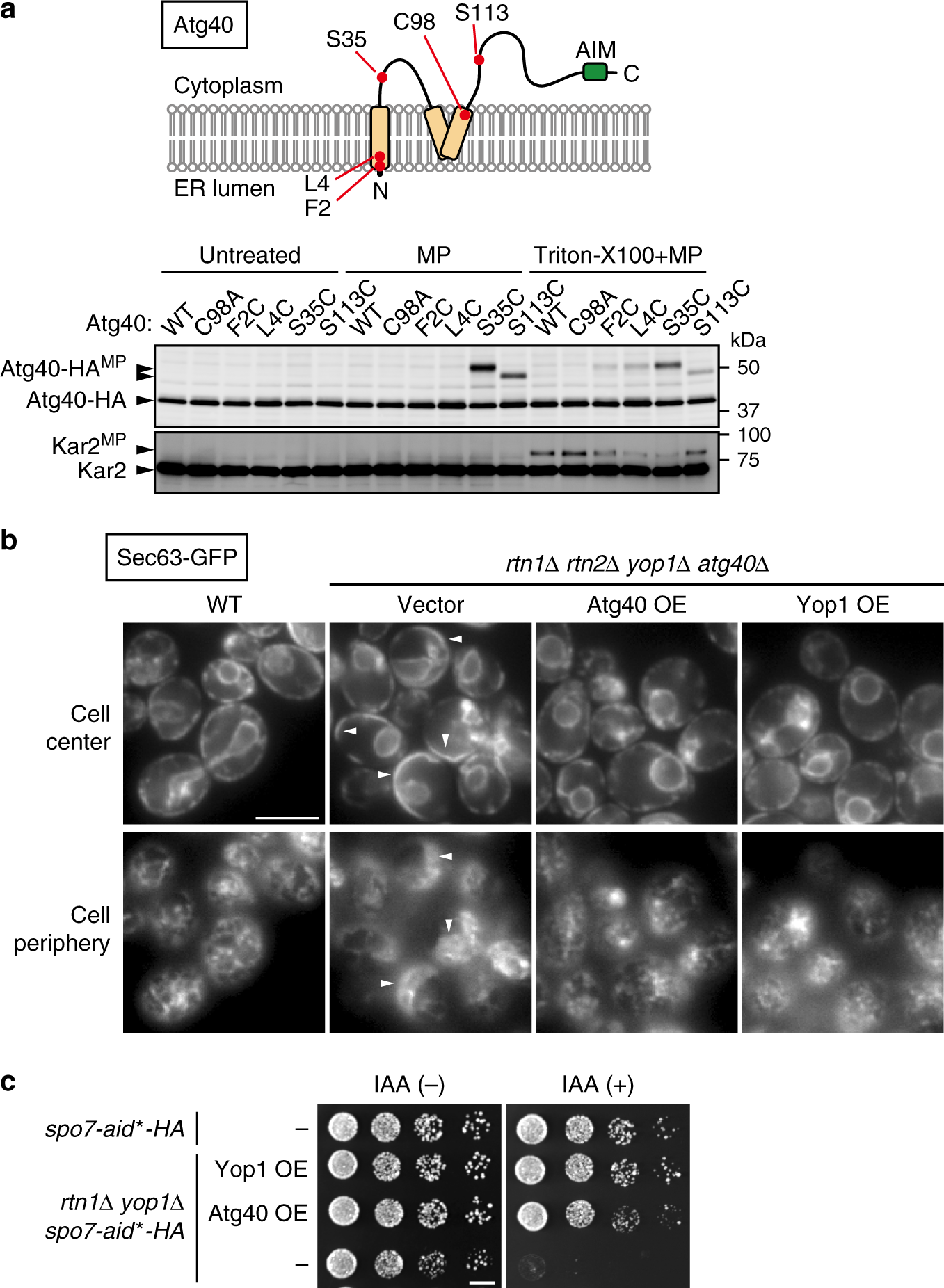 Fig. 1: Atg40 is a reticulon-like protein.