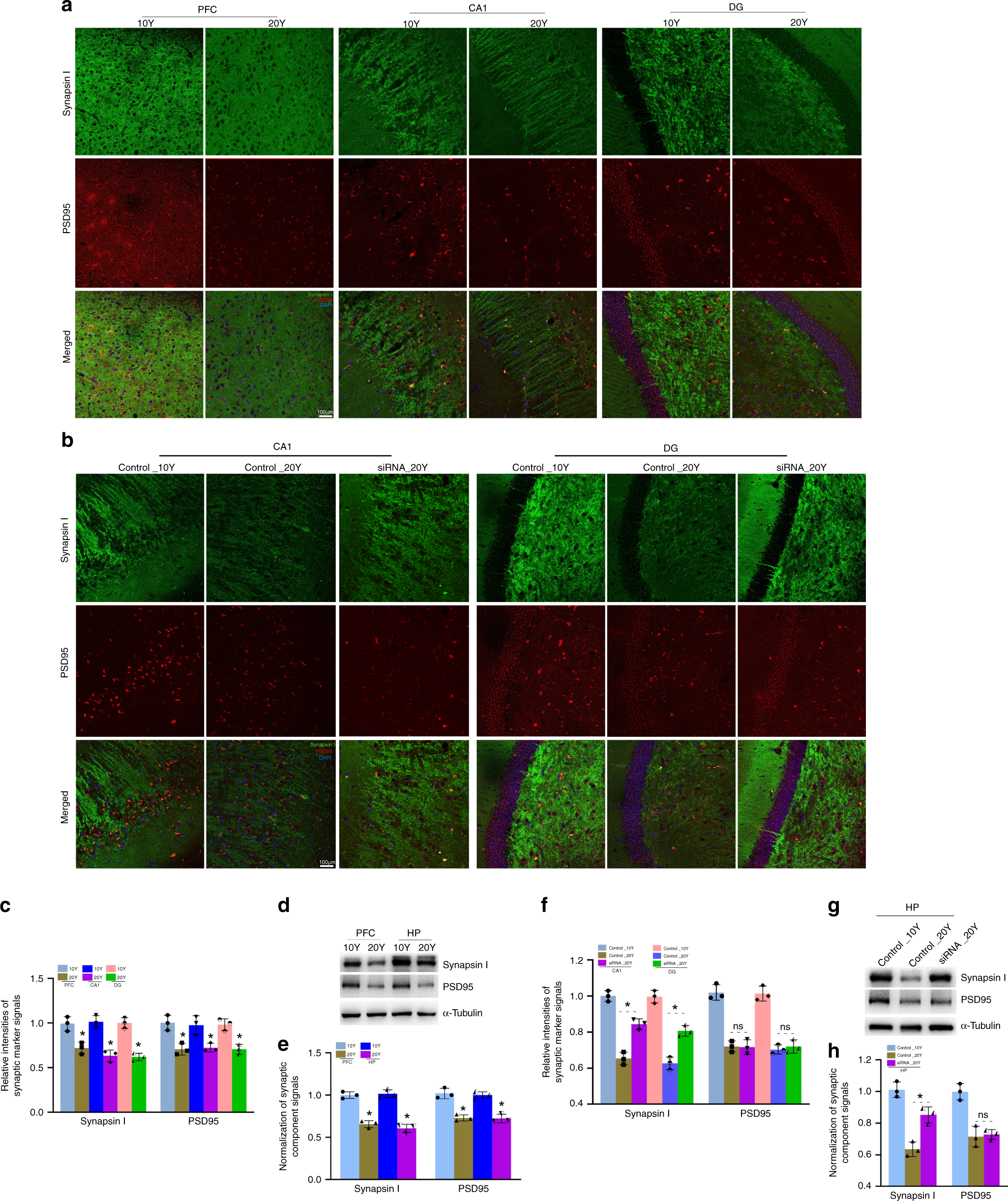 Fig. 6: Knockdown of circGRIA1 increases synaptogenesis.