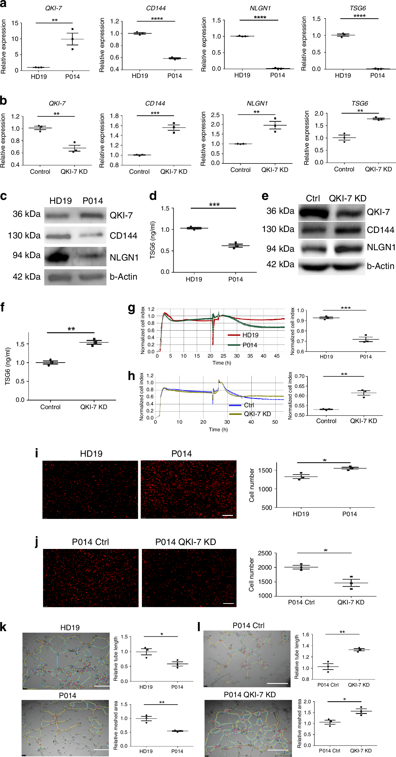 Fig. 4: QKI-7 in diabetic iPS-ECs was correlated with EC dysfunction.