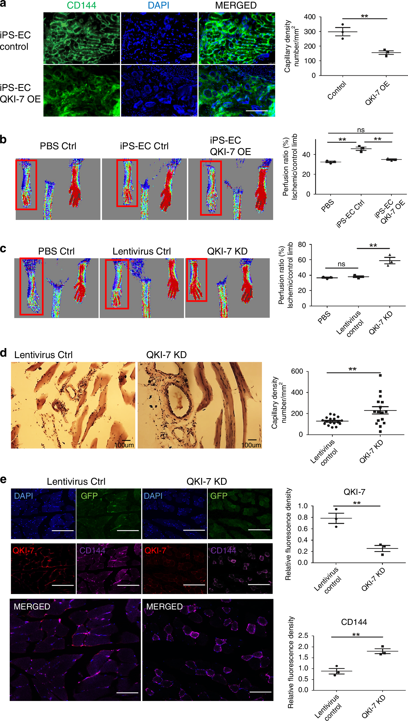 Fig. 7: QKI-7 affected blood reperfusion of the ischemic hindlimbs.