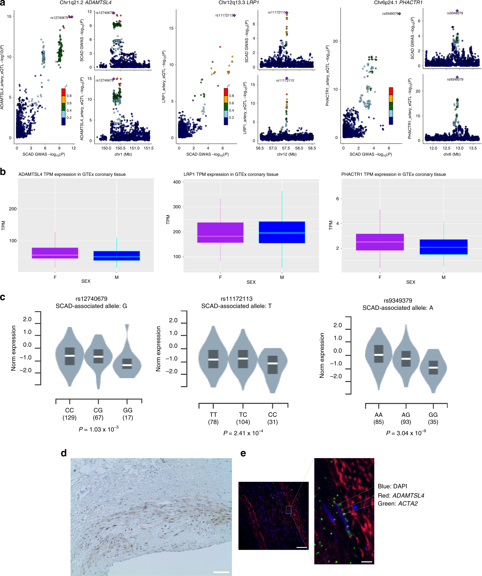 Fig. 3: Arterial expression of genes implicated by the SCAD GWAS meta-analysis.