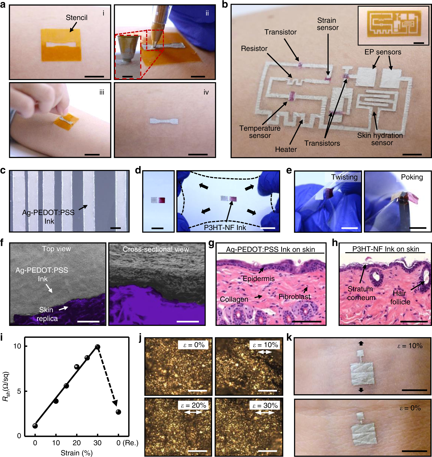 Ultra-conformal drawn-on-skin electronics for multifunctional motion  artifact-free sensing and point-of-care treatment | Nature Communications