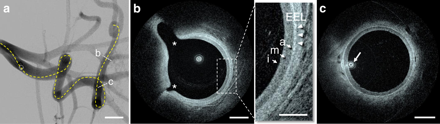 Fig. 2: In vivo imaging in a flexed forelimb model of brachial porcine artery.