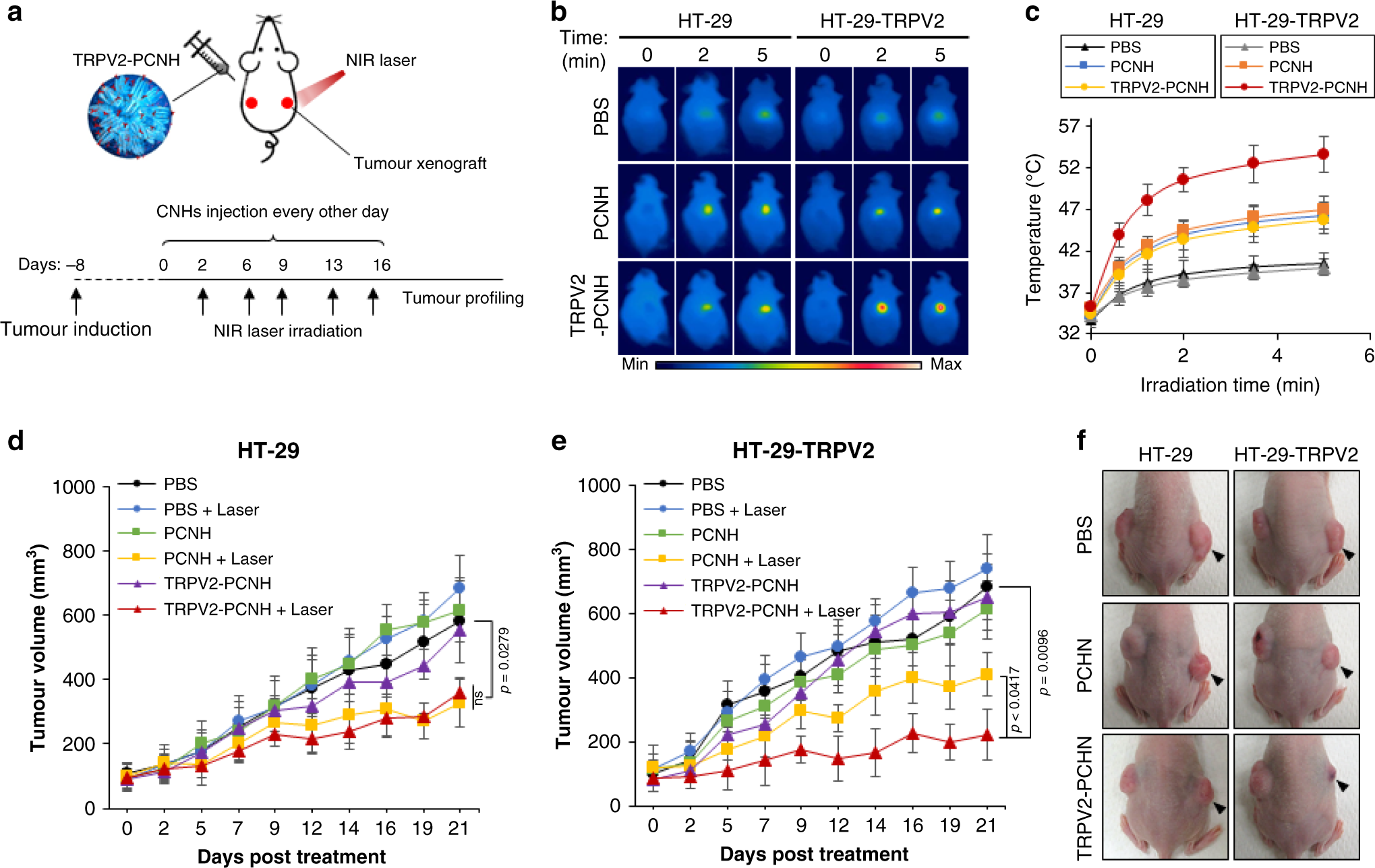 Fig. 5: Laser-induced TRPV2-PCNH inhibits tumour progression in in vivo xenograft models with TRPV2 overexpression.
