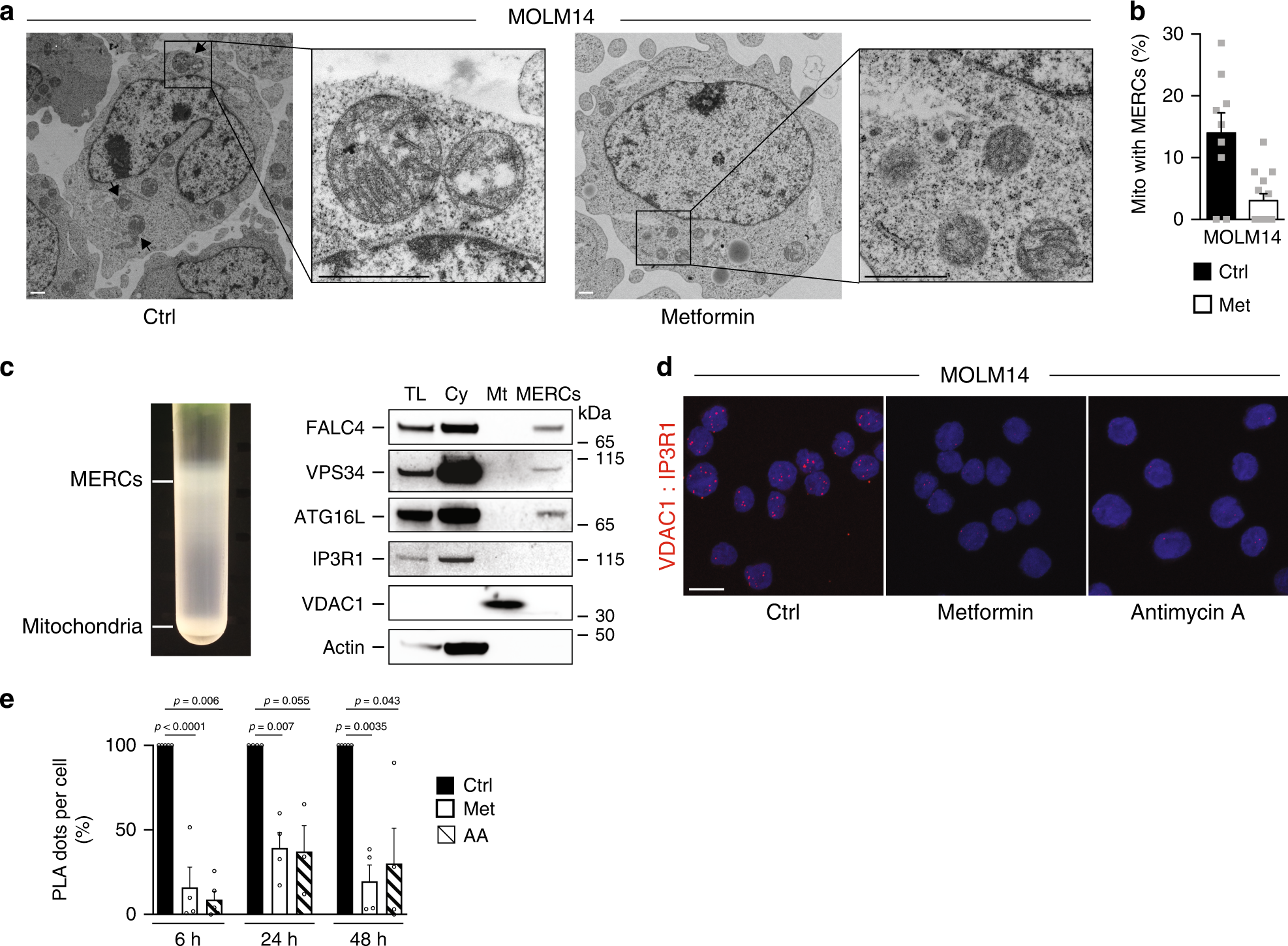 Fig. 4: OxPHOS regulates MERCs number and function.
