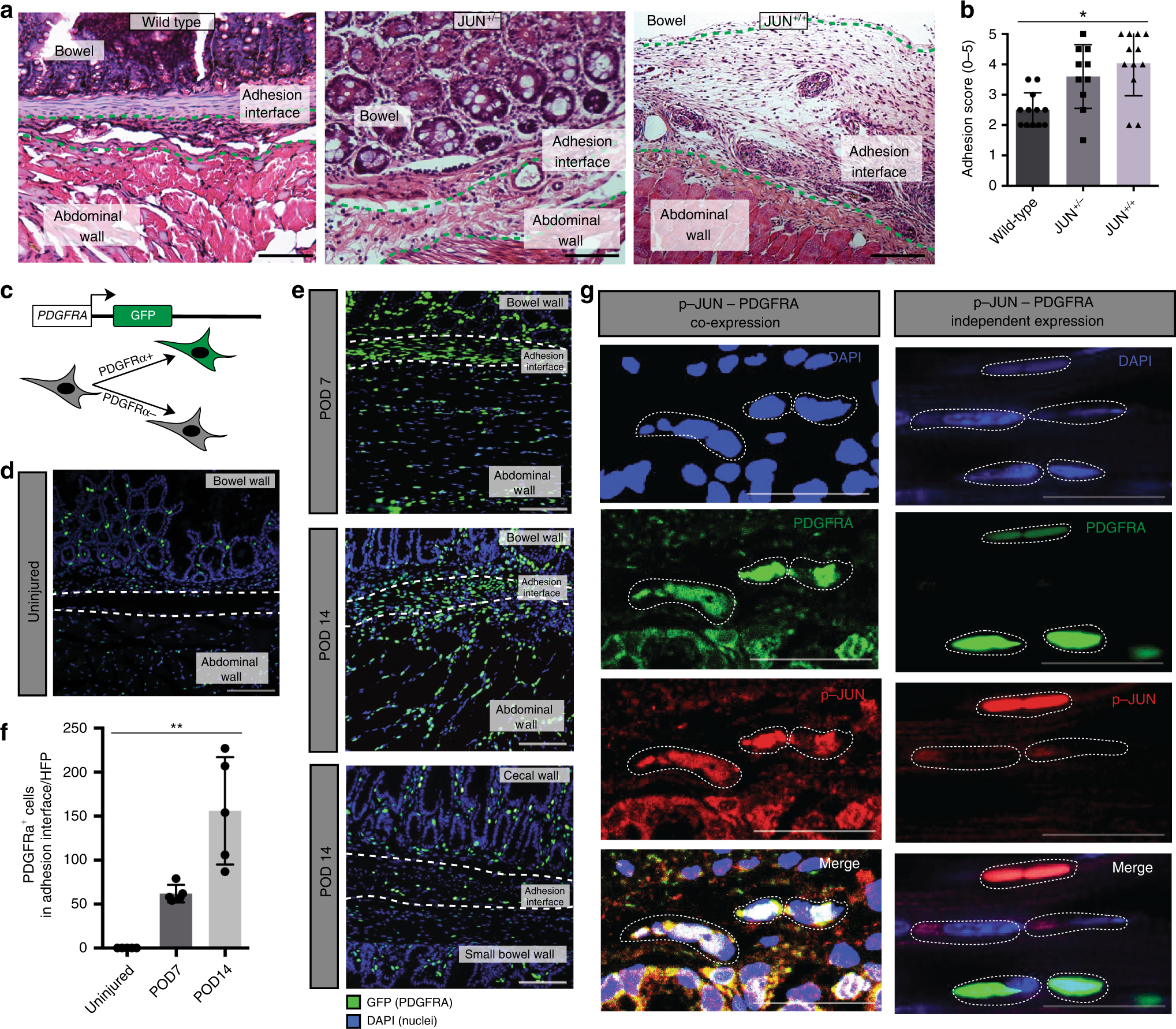 Elucidating the fundamental fibrotic processes driving abdominal