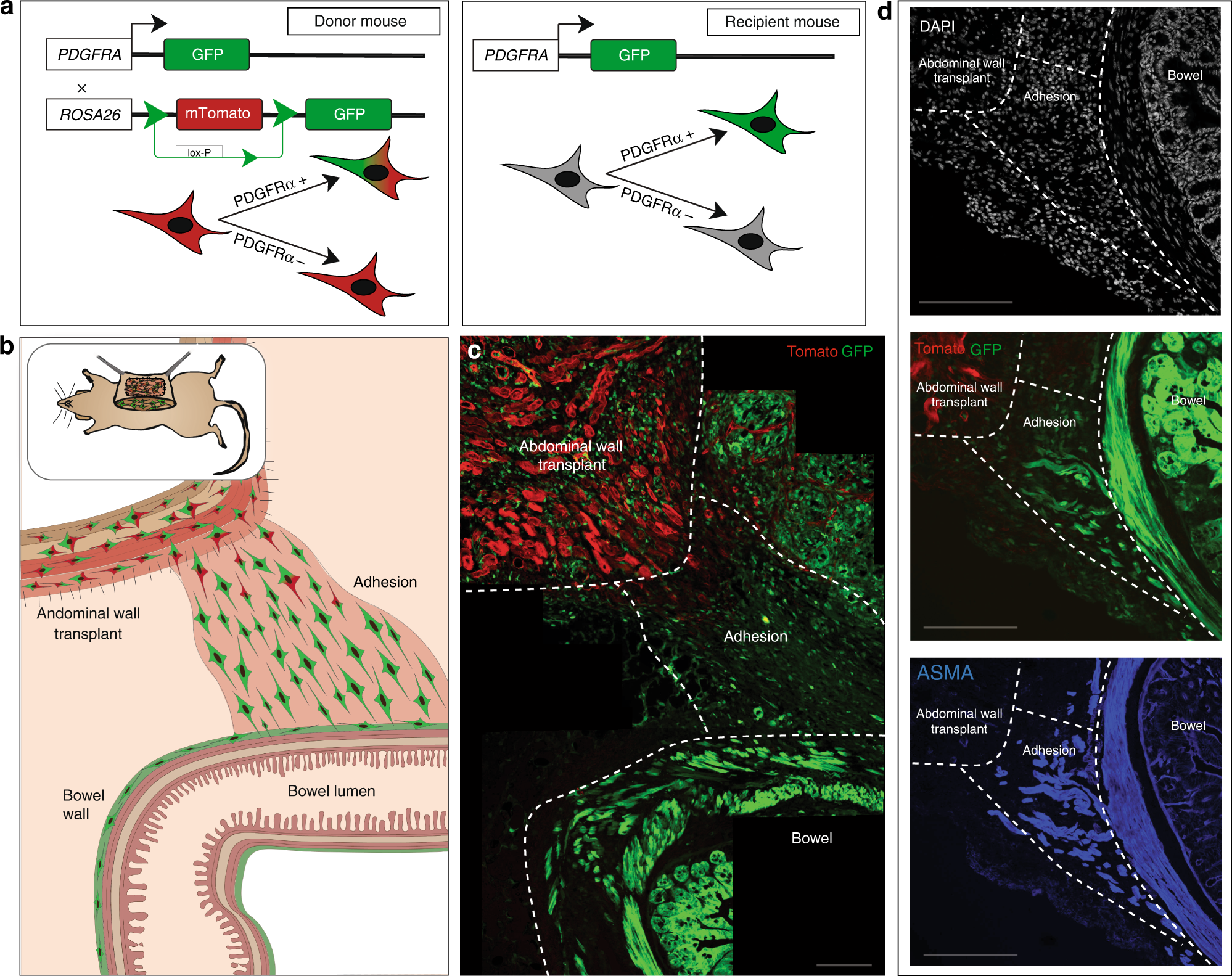 Fig. 3: Adhesion fibroblasts derive primarily from the viscera.