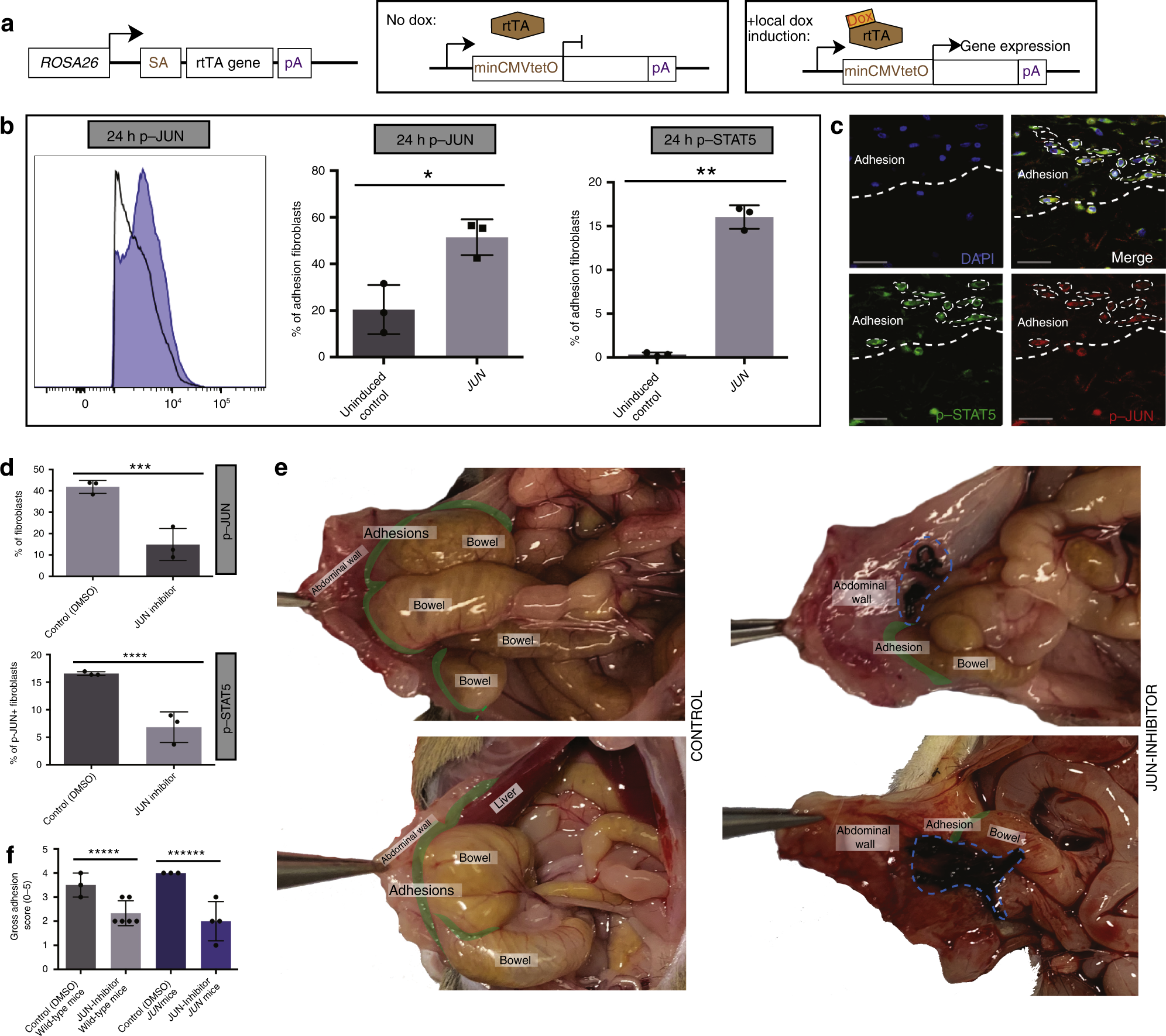 Fig. 5: JUN is an early promotor of abdominal adhesion fibrosis.