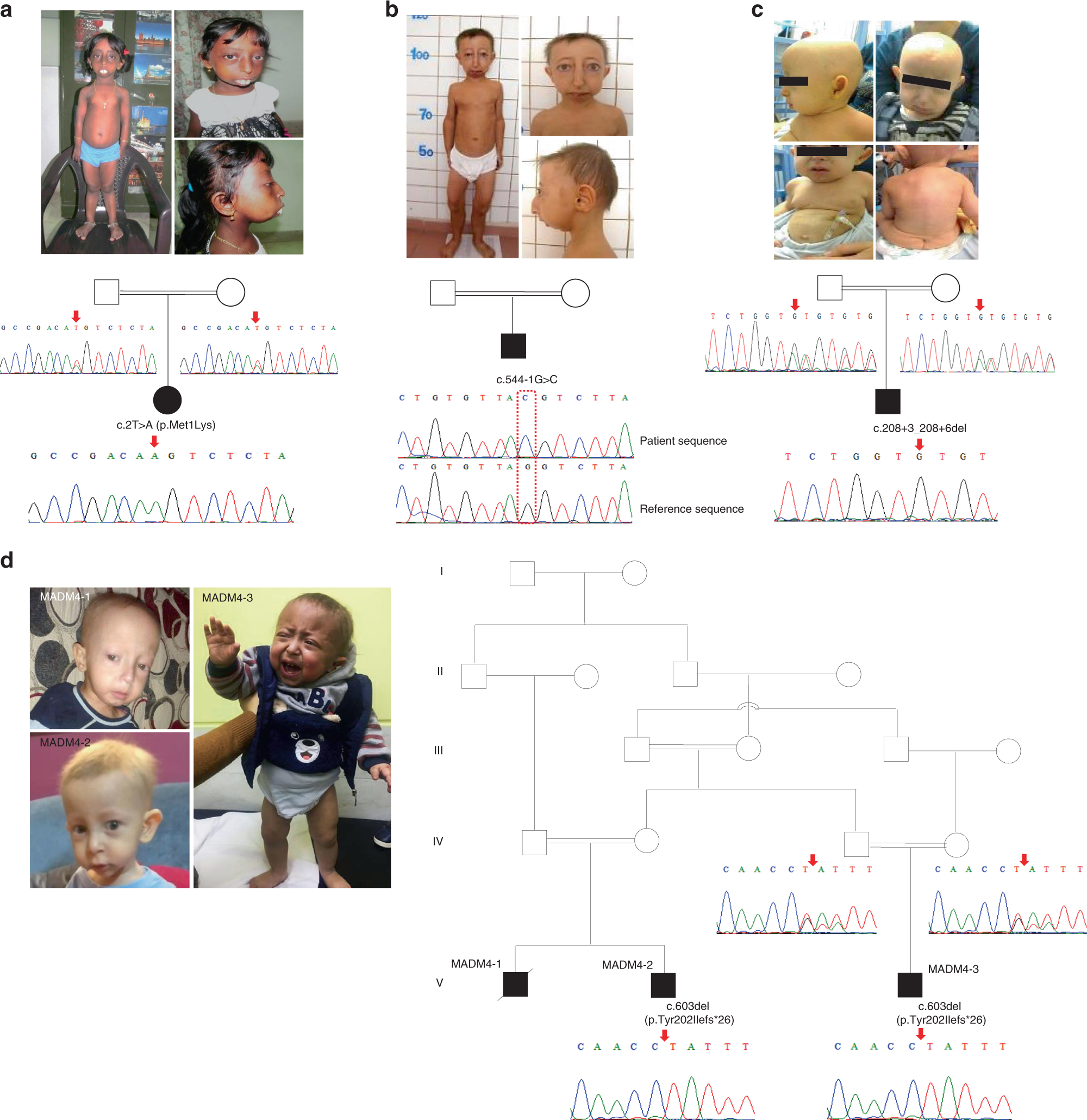 Fig. 1: Patients’ clinical features and MTX2 mutations.