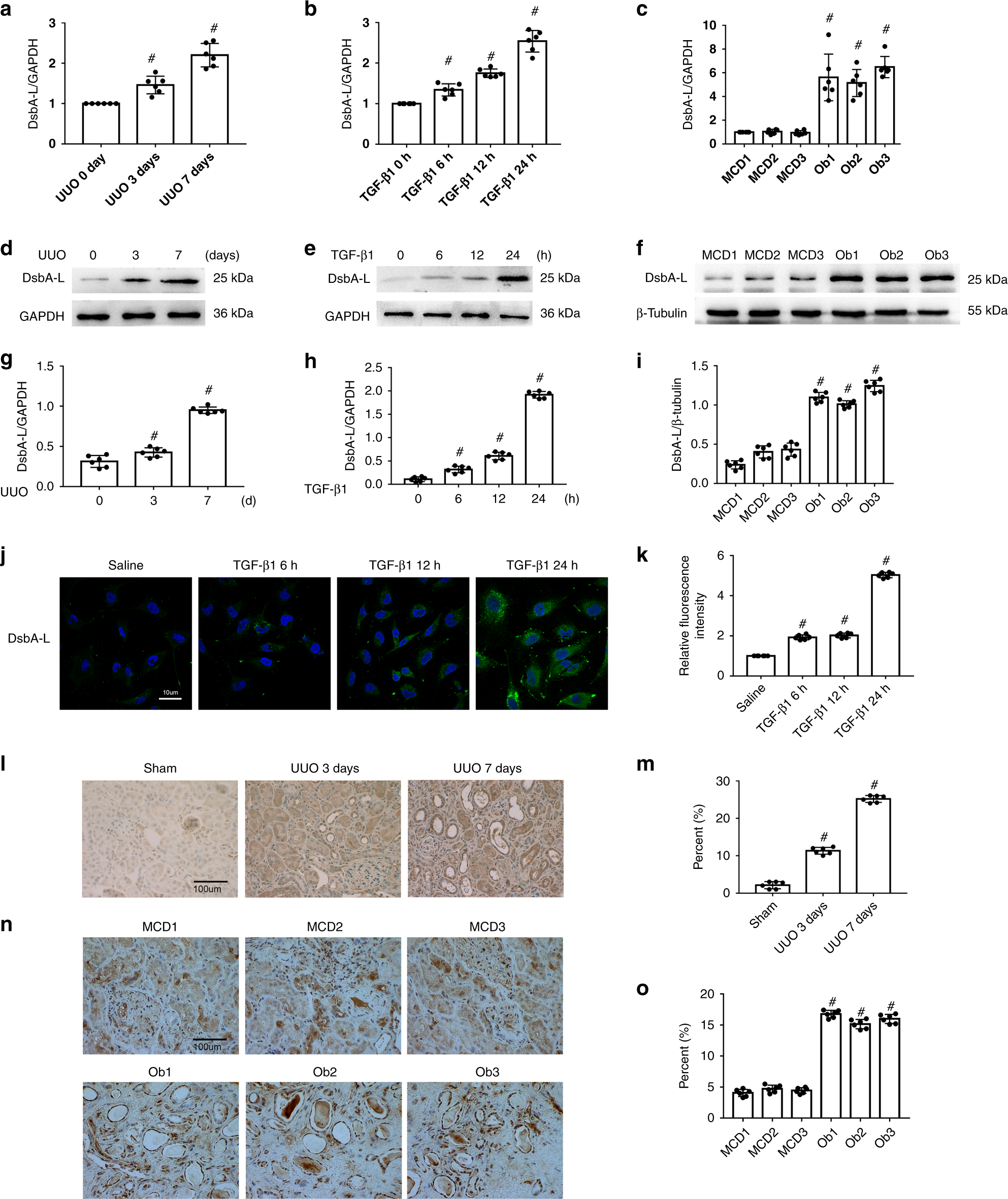 Fig. 1: Induction of DsbA-L in BUMPT cells treated by TGF-β1 and the kidneys of UUO mice and Ob patients.