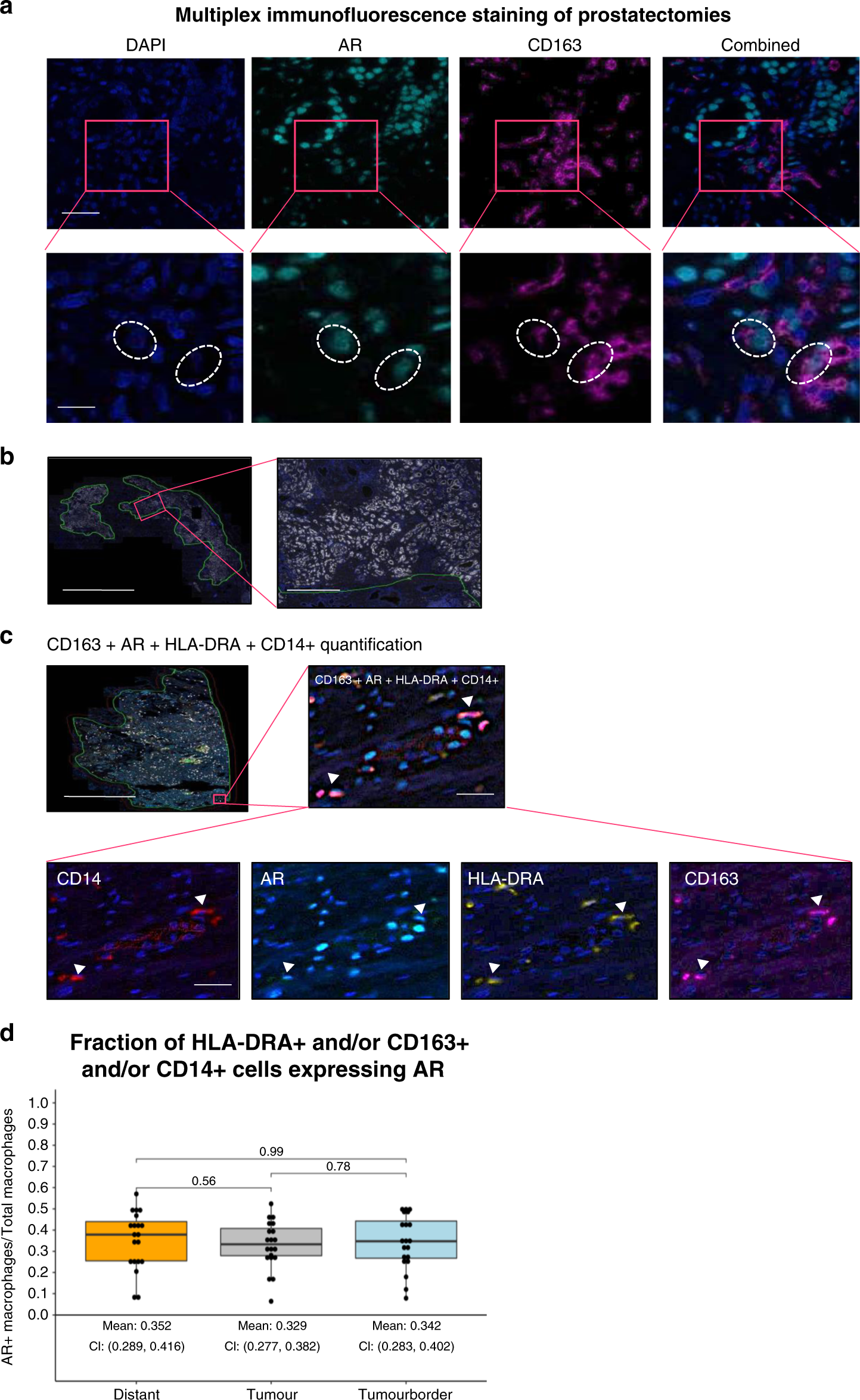 Androgen Receptor Signalling In Macrophages Promotes Trem 1 Mediated Prostate Cancer Cell Line Migration And Invasion Nature Communications