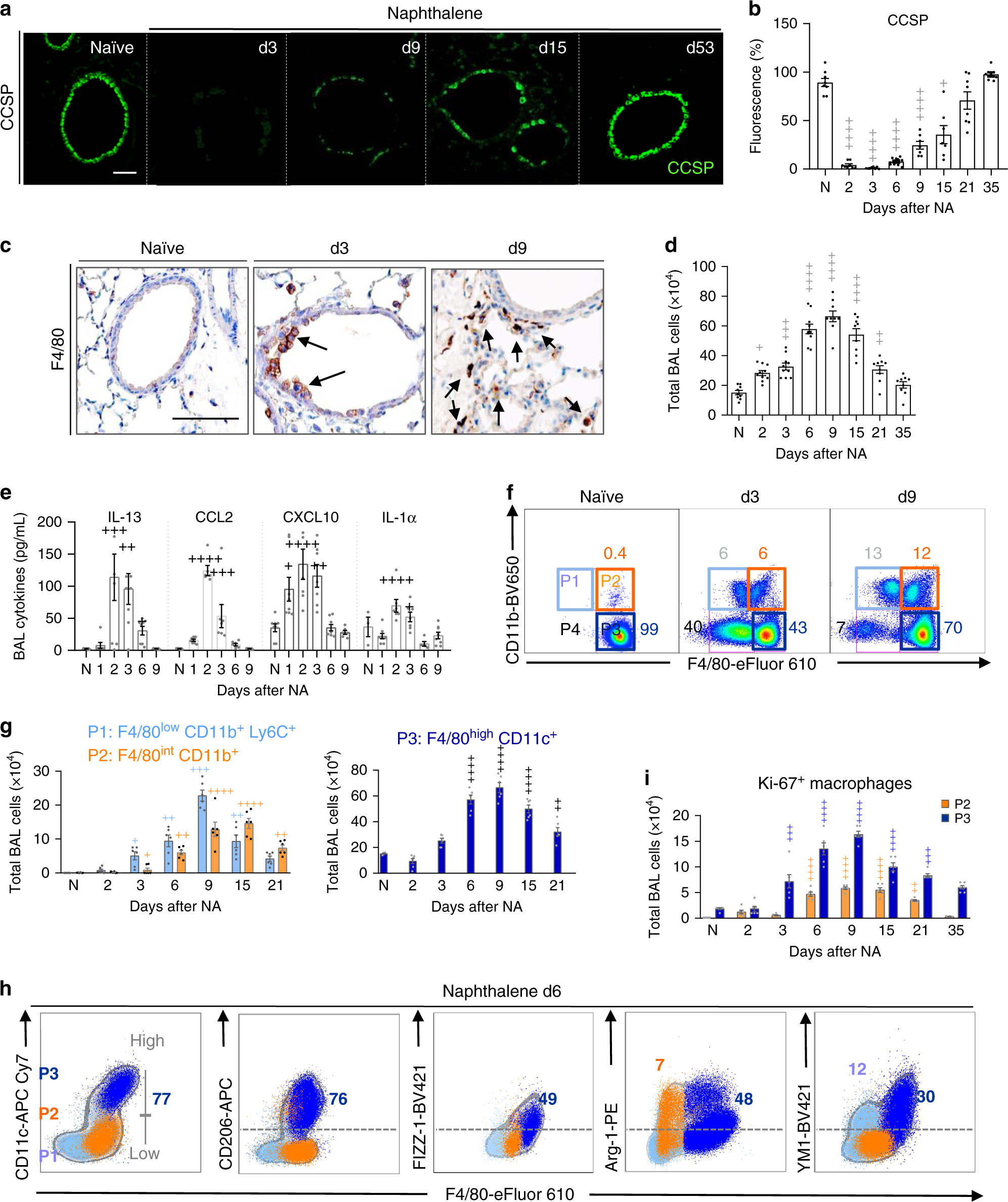 IL-33-ST2 axis regulates myeloid cell differentiation and activation  enabling effective club cell regeneration | Nature Communications