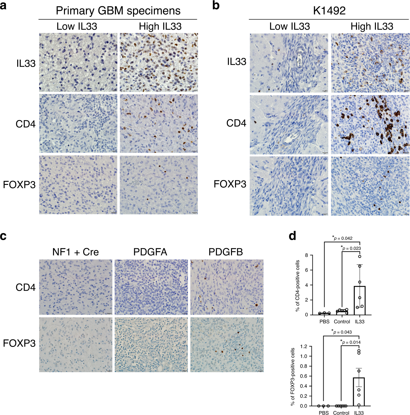 Fig. 6: FOXP3+ T cells in IL-33-expressing tumors.