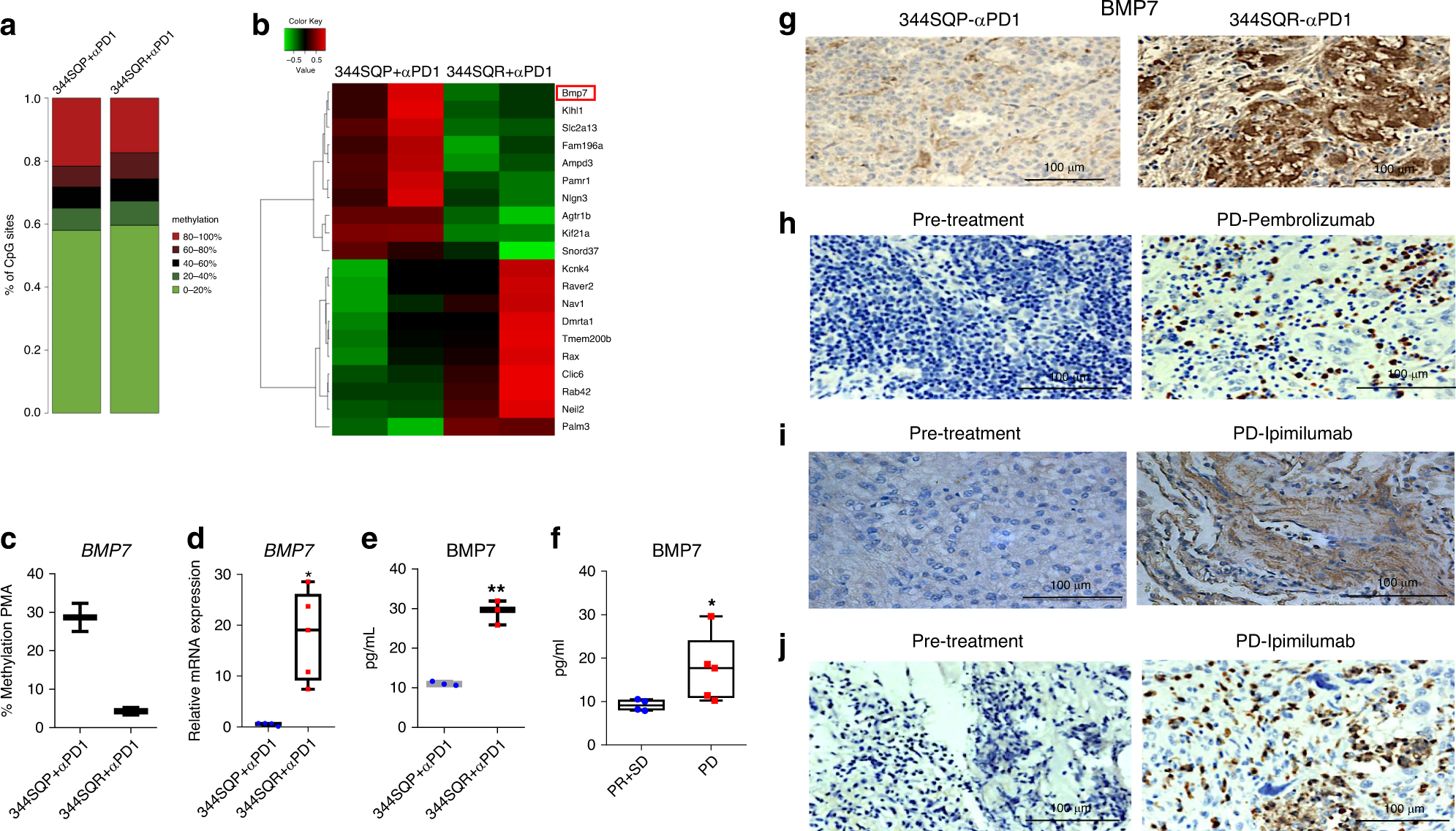 Fig. 1: BMP7 is upregulated in tumors resistant to immunotherapies.
