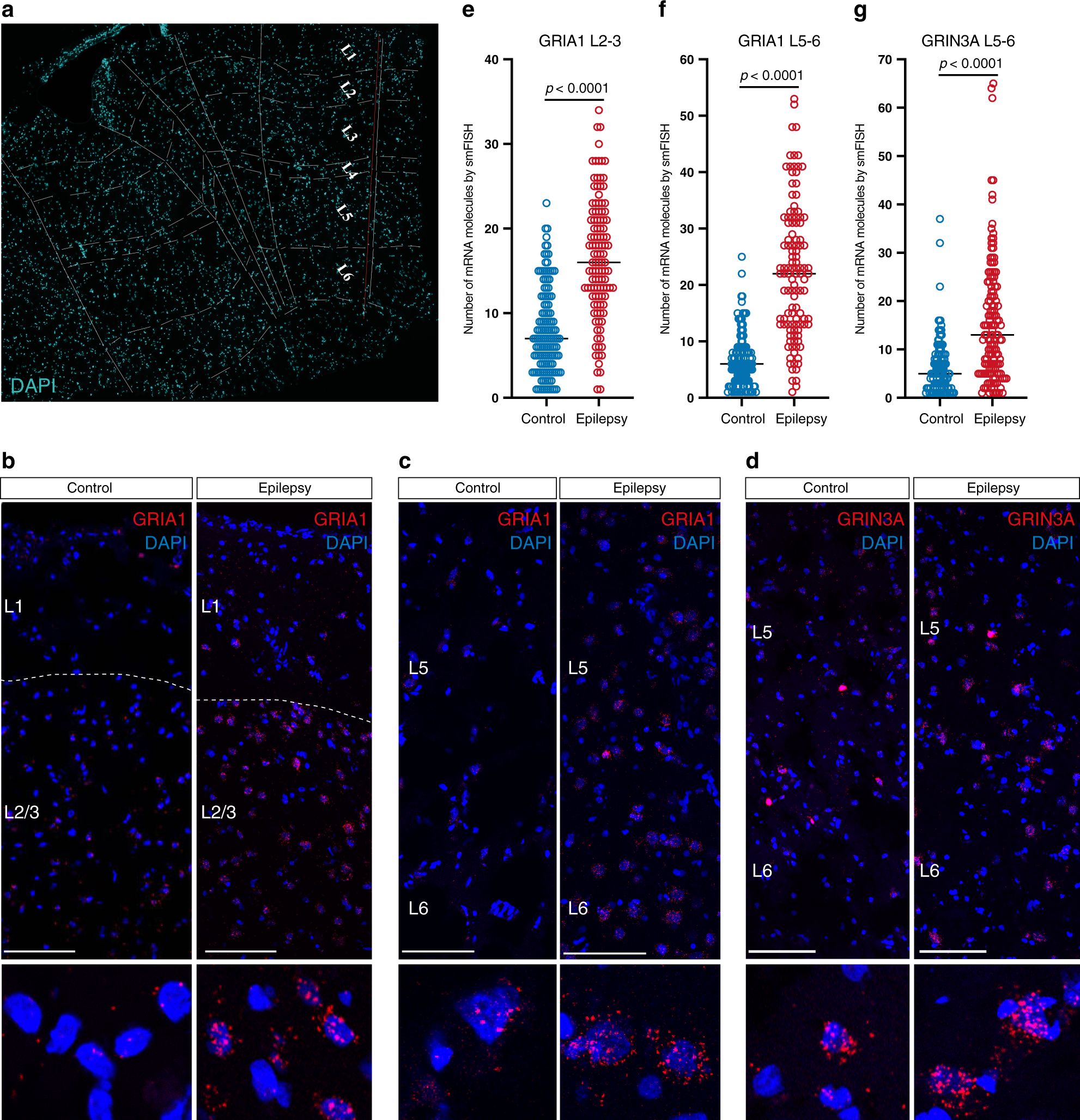 Fig. 6: Layer-wise dysregulation of gene expression of glutamate receptor subunits in the cortex of epileptic patients.