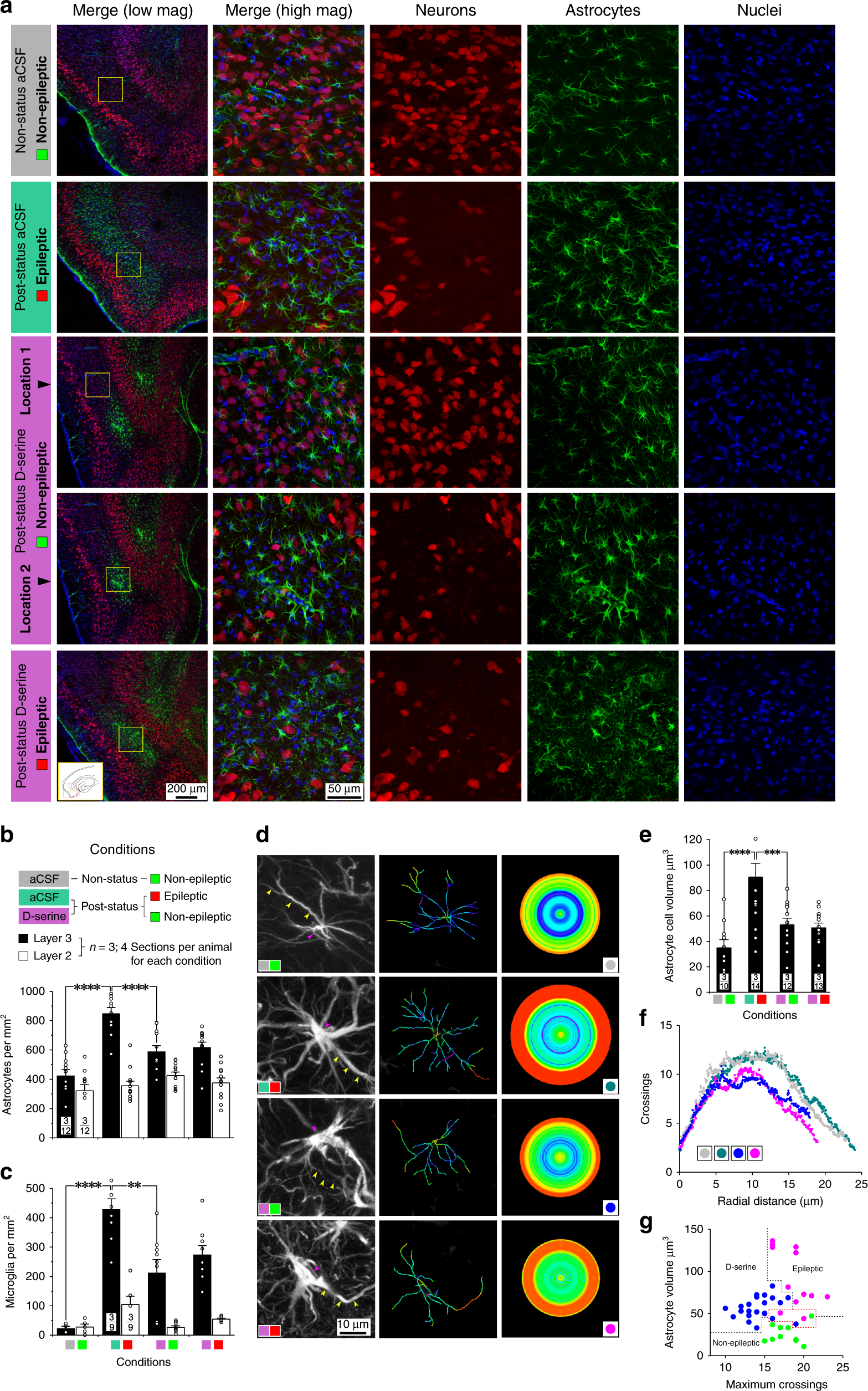 Fig. 3: Focal application of D-serine minimizes astrocytic density in layer 3 of the MEA.