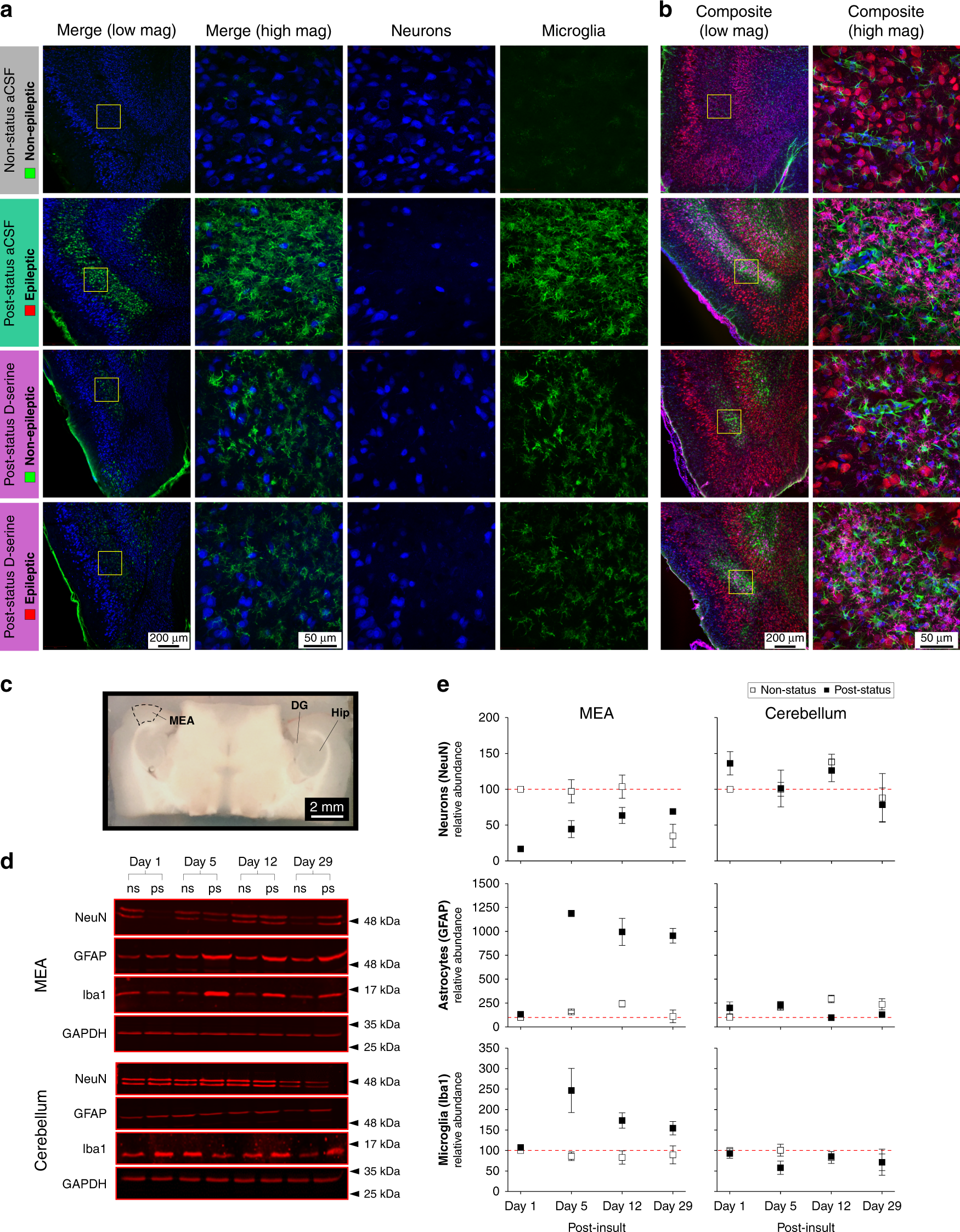Fig. 4: Focal application of D-serine limits microglia proliferation and/or infiltration into layer 3 of the MEA.
