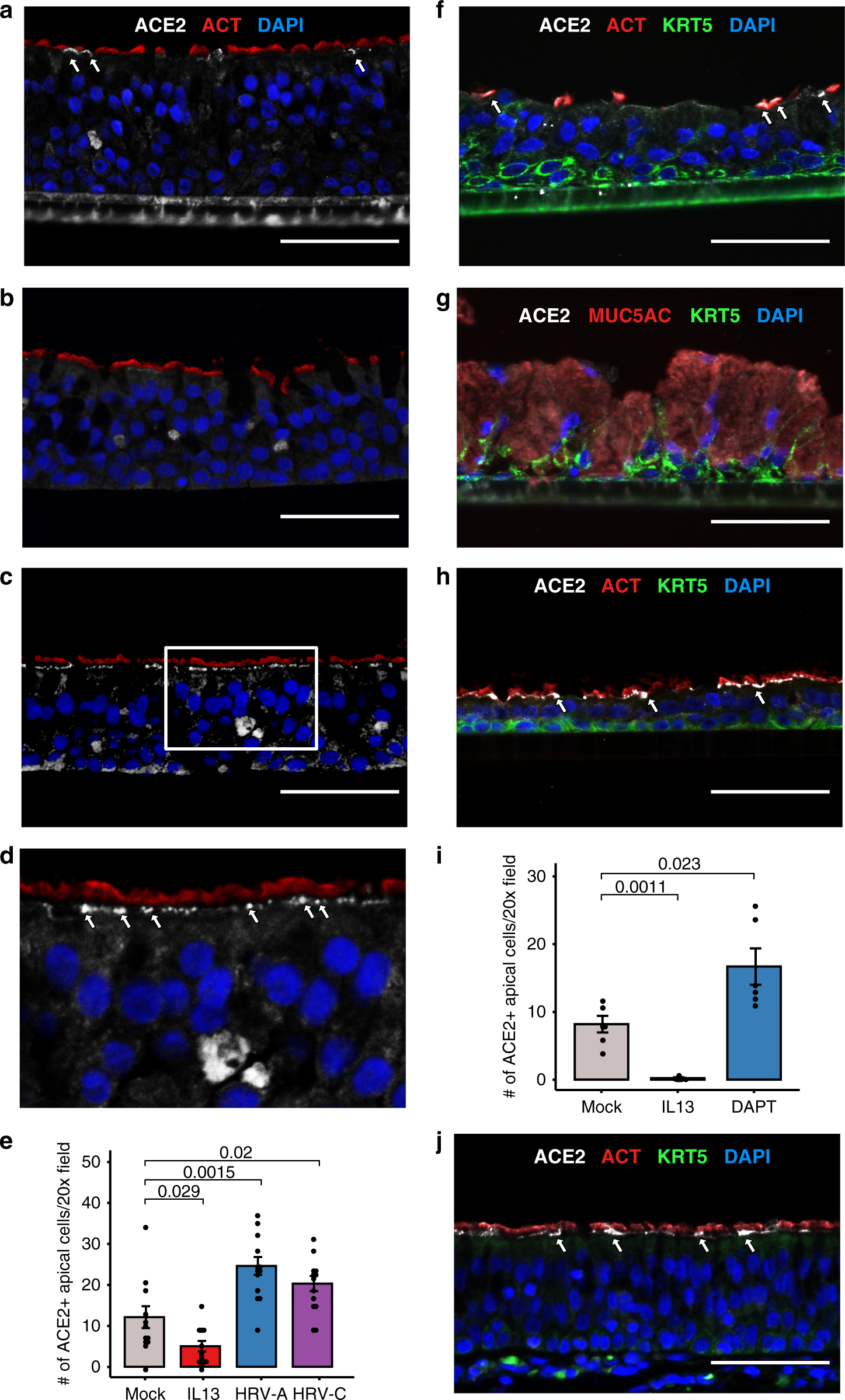 Fig. 5: Airway surface ACE2 protein is regulated by IL-13 and viral infection.