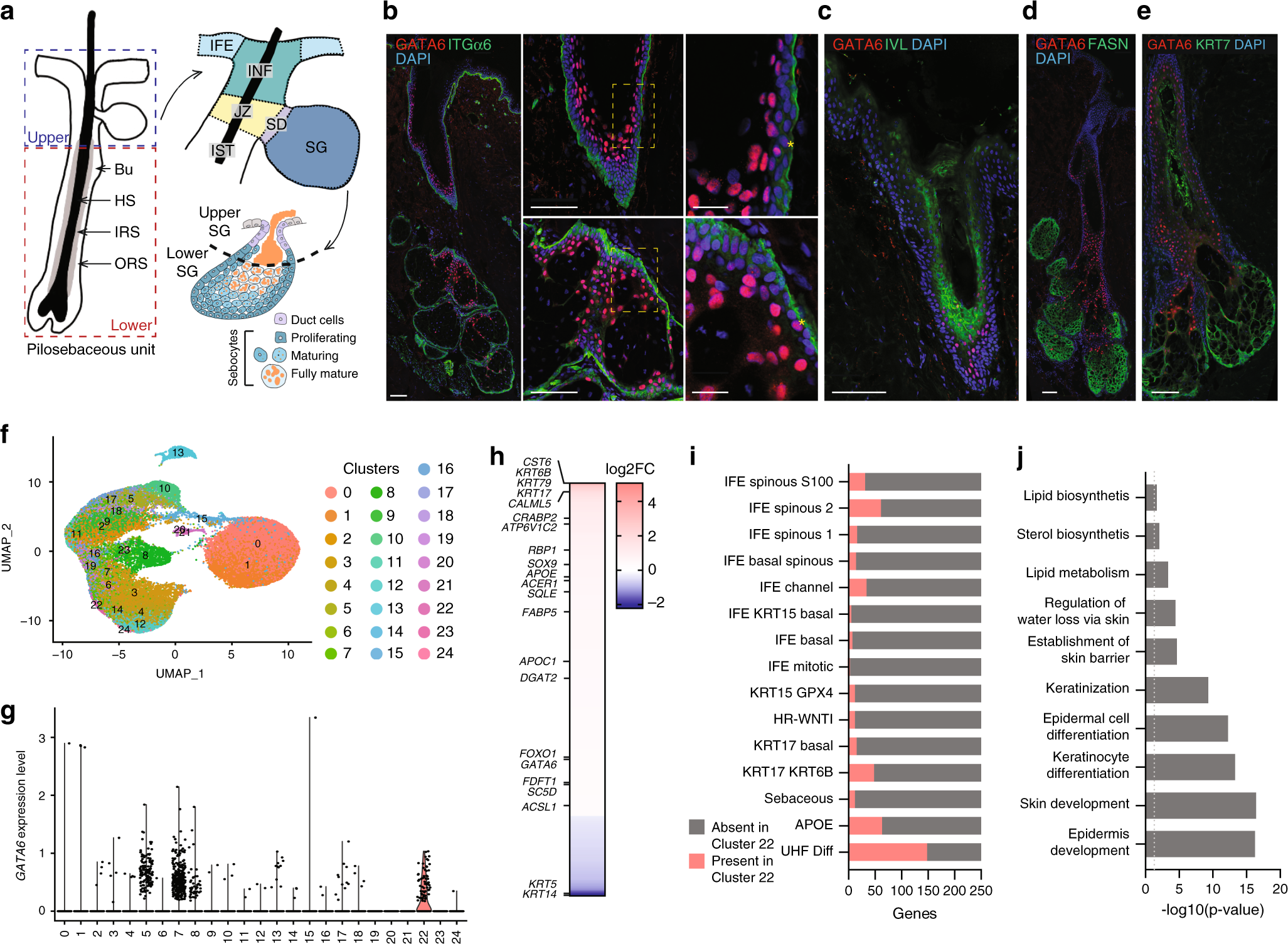Contribution of GATA6 to homeostasis of the human upper pilosebaceous unit  and acne pathogenesis | Nature Communications
