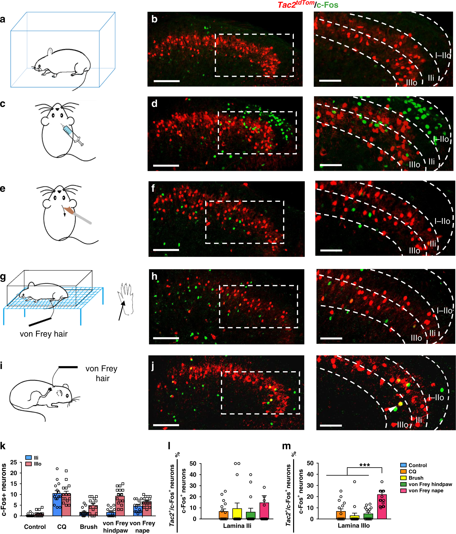 A Spinal Neural Circuitry For Converting Touch To Itch Sensation Nature Communications<script async src=