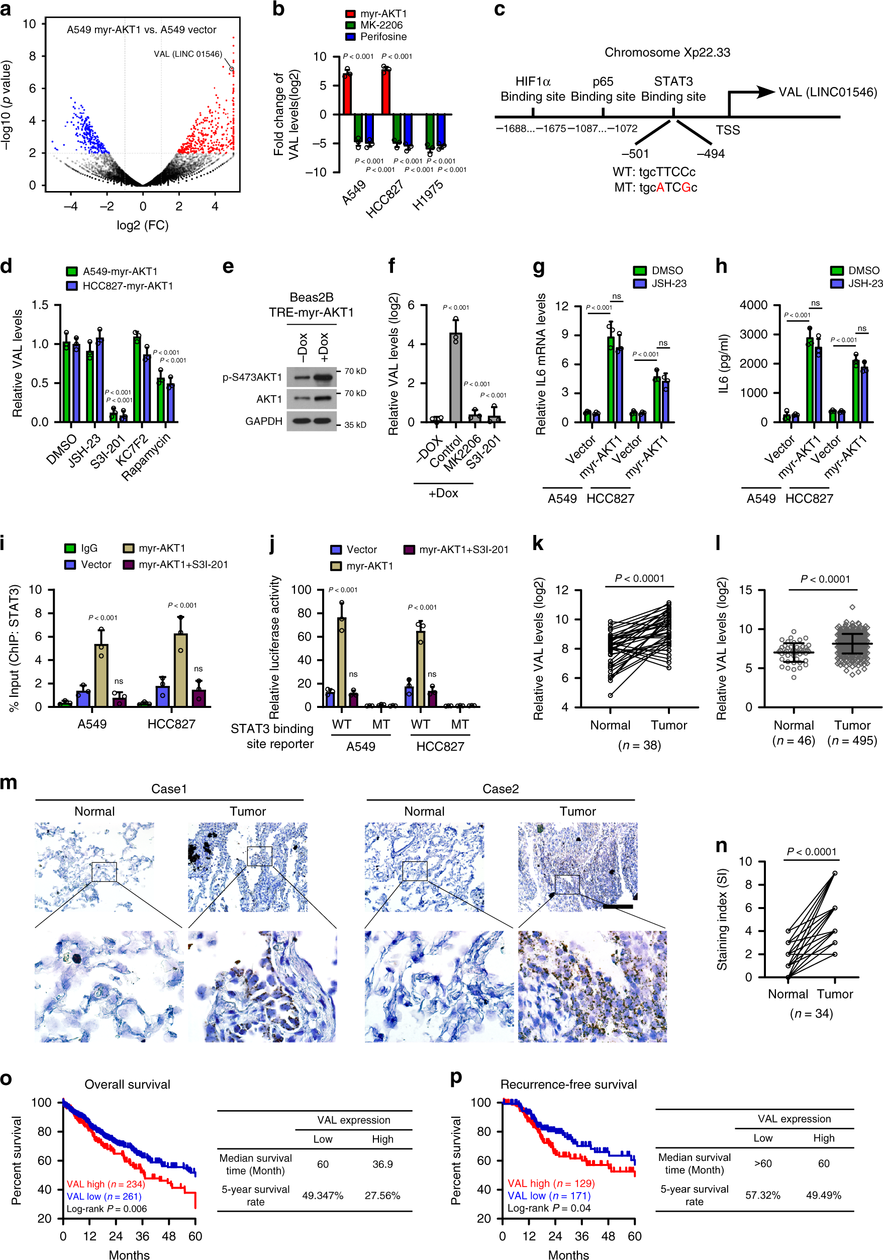 Fig. 1: AKT/STAT3-induced VAL correlates with poor prognosis of LAD.