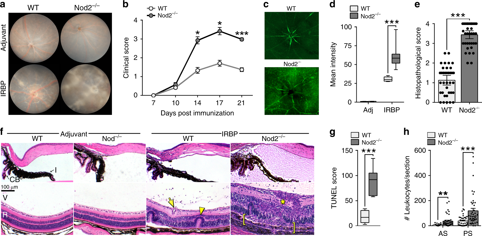 Fig. 1: Nod2 plays an unexpected protective role in uveitis.