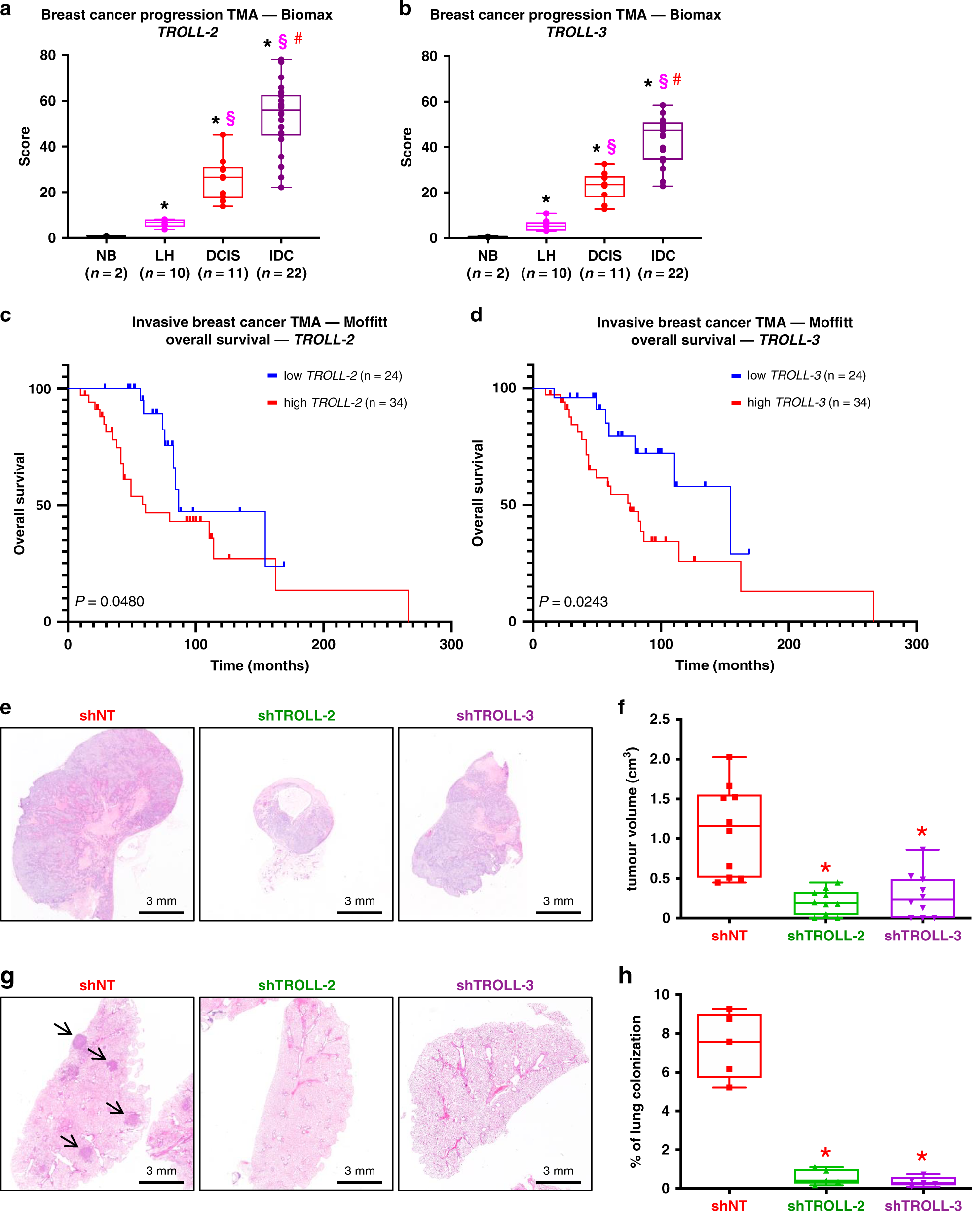 Fig. 2: TROLL-2 and TROLL-3 are markers of breast cancer progression.