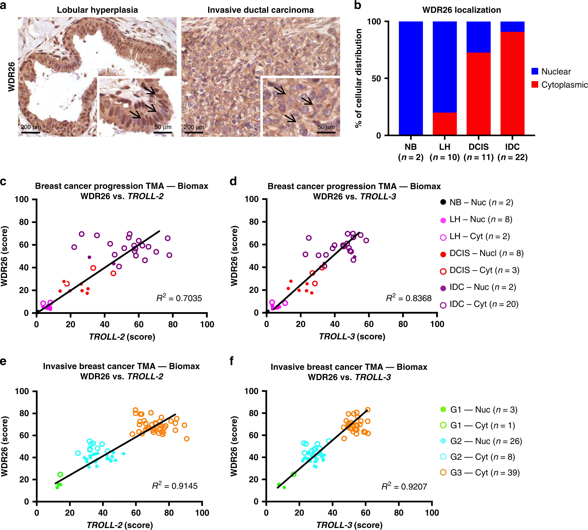 Fig. 4: WDR26 localization correlates with breast cancer progression.