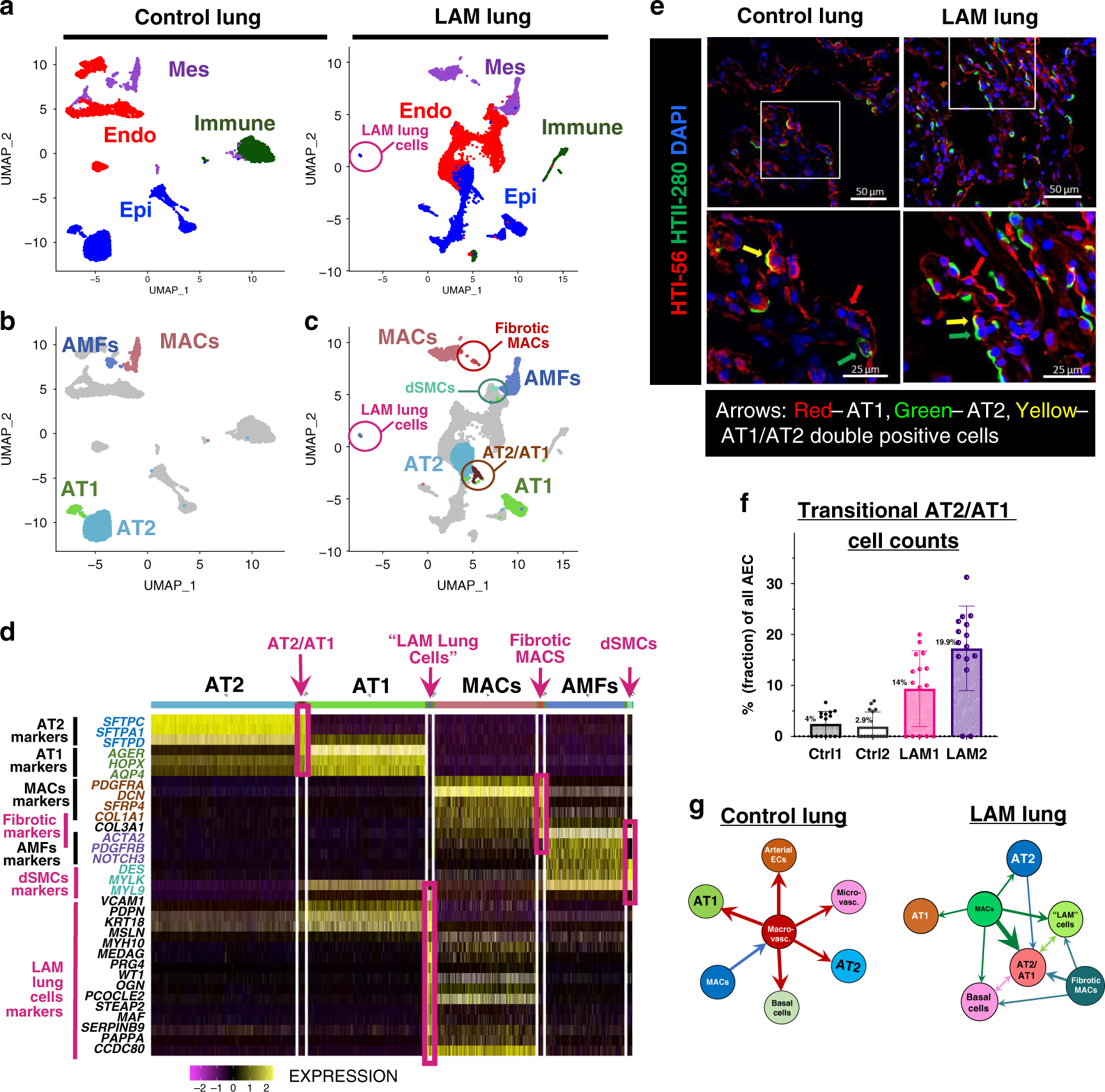 Fig. 2: Single-cell RNA-seq identifies distinct LAM lung cells and transitional alveolar epithelial and mesenchymal cells.