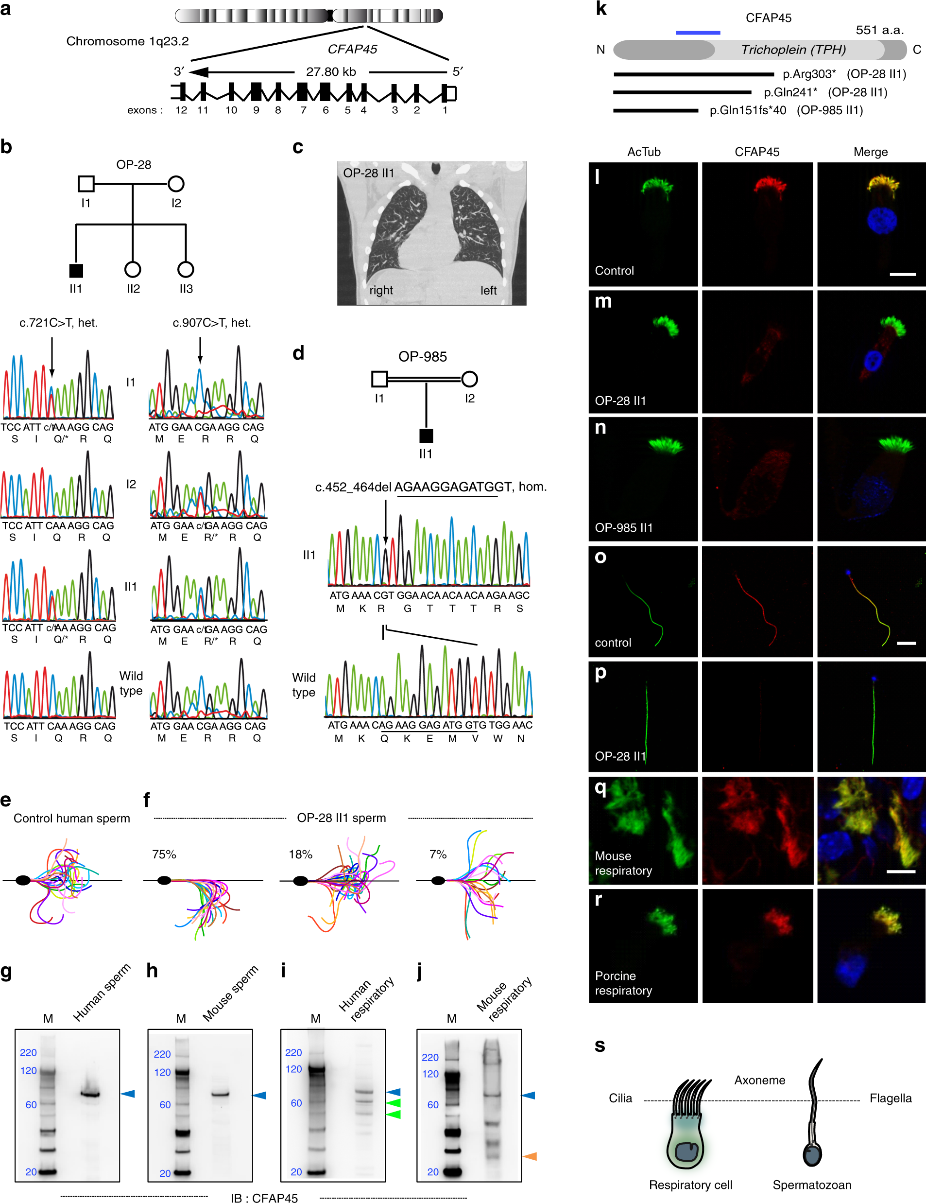 CFAP45 deficiency causes situs abnormalities and asthenospermia by  disrupting an axonemal adenine nucleotide homeostasis module | Nature  Communications