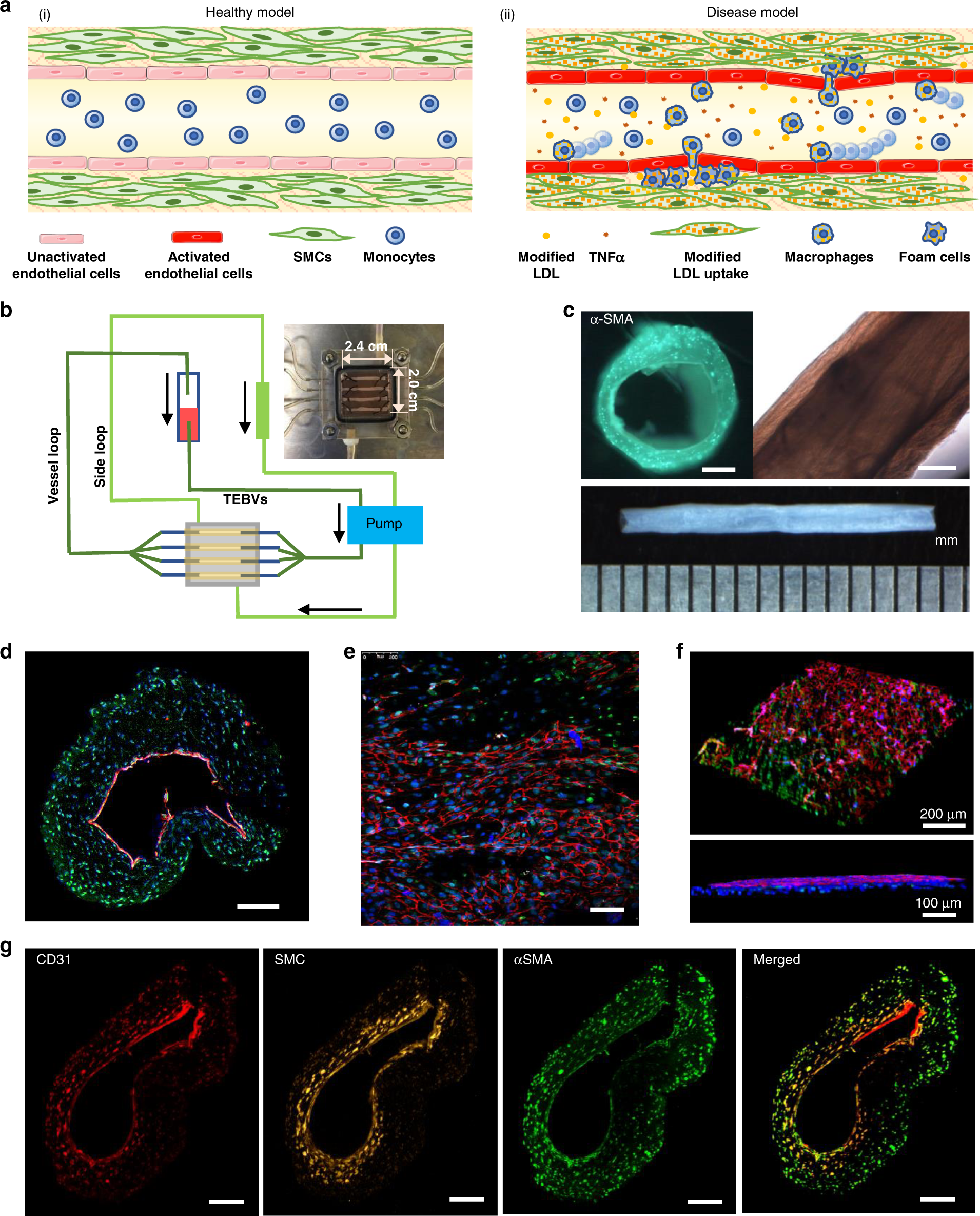 Modeling early stage atherosclerosis in a primary human vascular  microphysiological system | Nature Communications