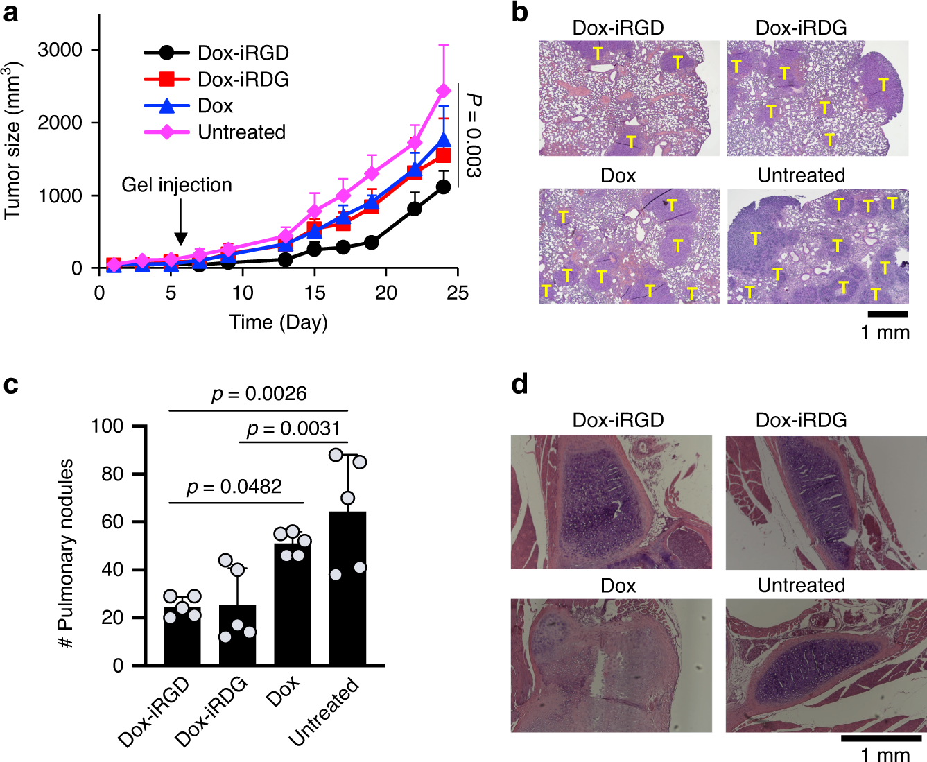 Fig. 3: Pore-forming alginate gels containing Dox-iRGD and GM-CSF delay 4T1 tumor growth and reduce metastases.