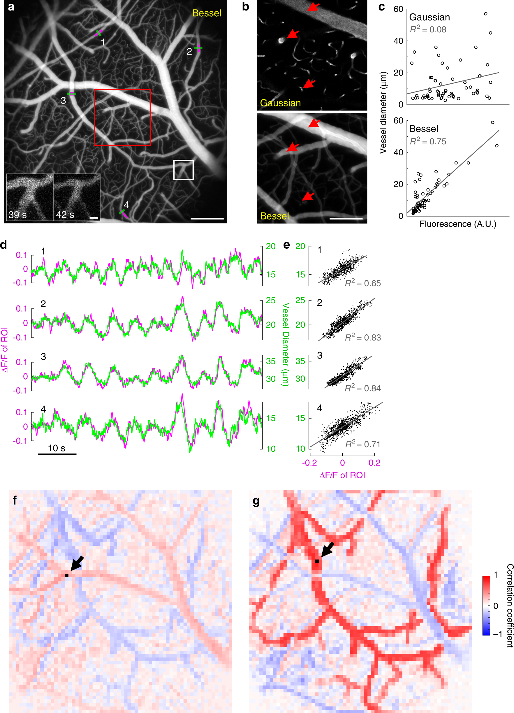 Fig. 3: Bessel TPLSM signal is correlated with vessel size and captures distributed dynamics of vasodilation and vasoconstriction in 3D.