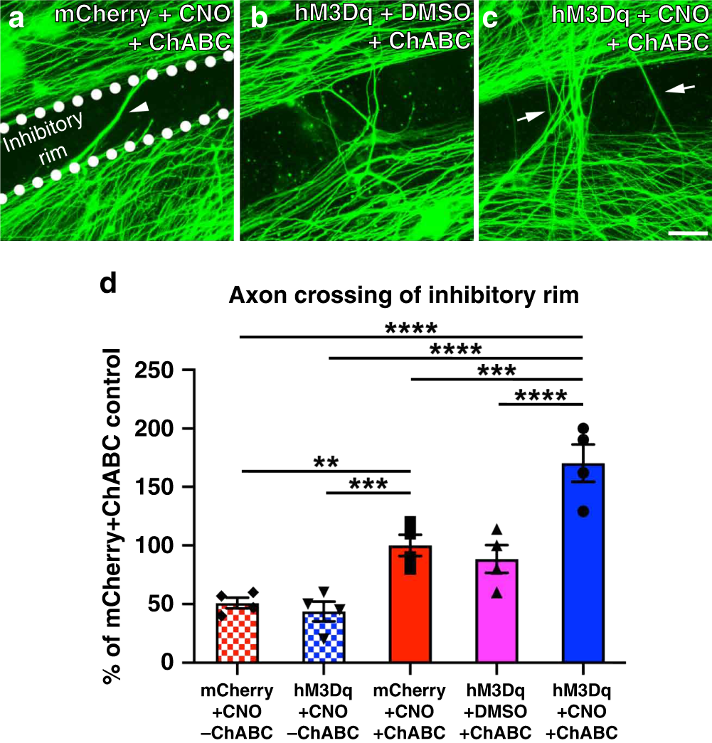 Chronic neuronal activation increases dynamic microtubules to enhance  functional axon regeneration after dorsal root crush injury | Nature  Communications