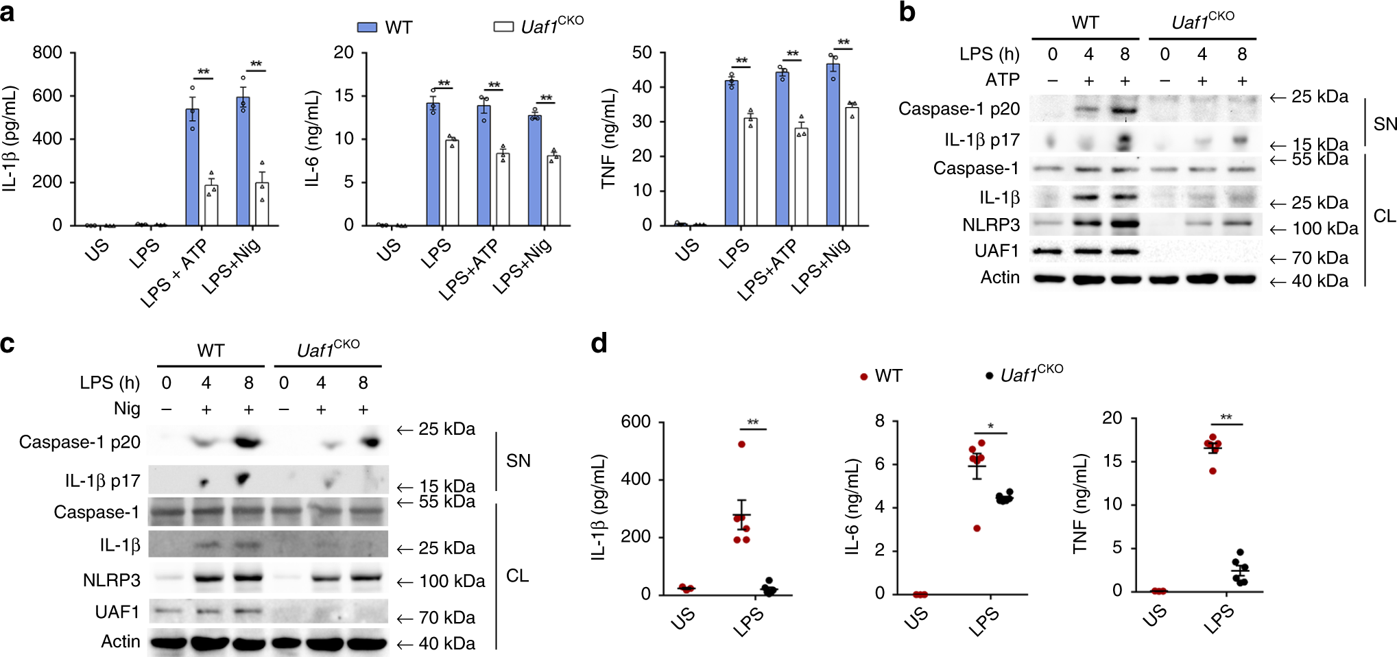 The ubiquitylation of IL-1β limits its cleavage by caspase-1 and targets it  for proteasomal degradation