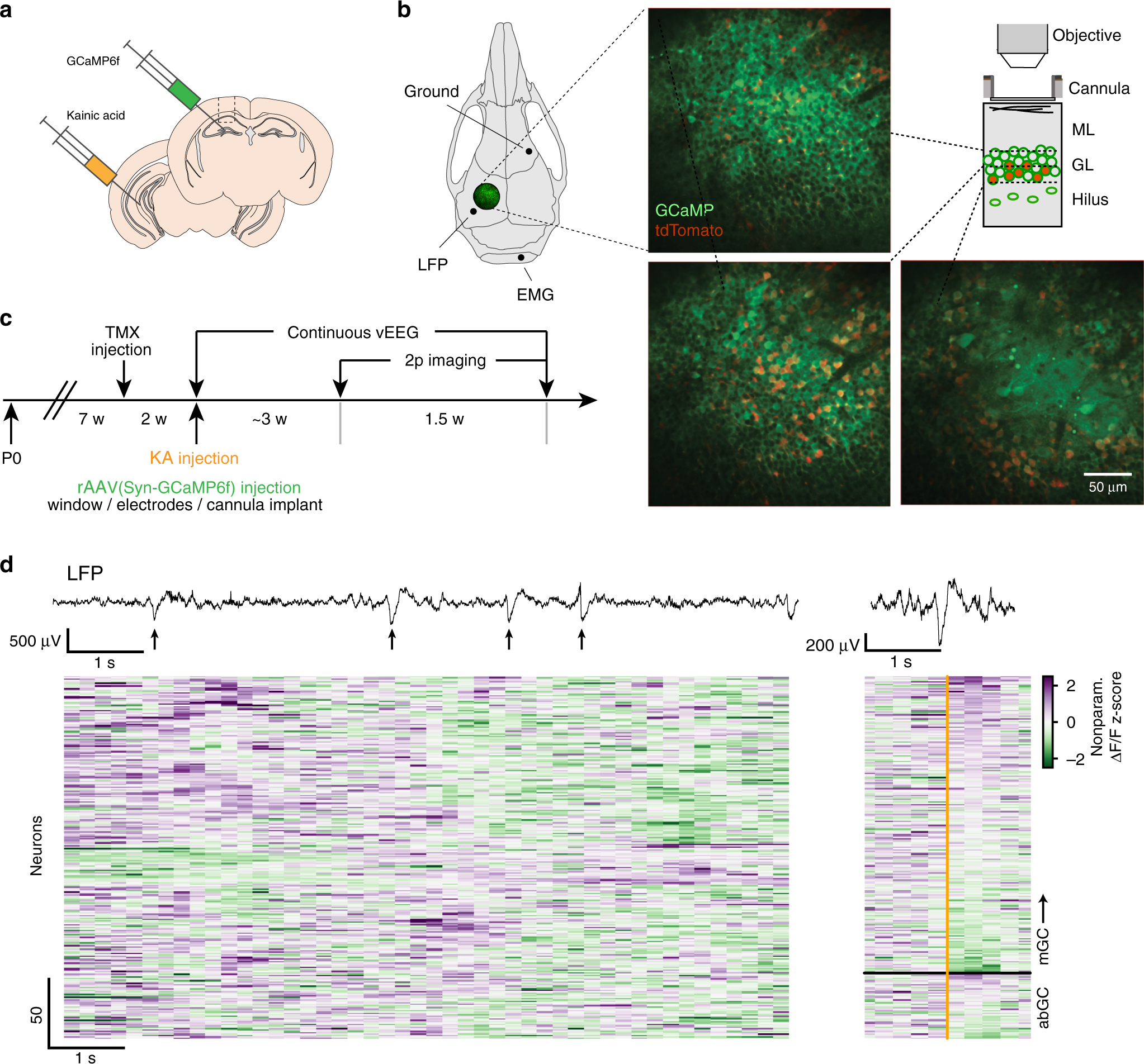 Hippocampal adult-born granule cells drive network activity in a mouse  model of chronic temporal lobe epilepsy | Nature Communications