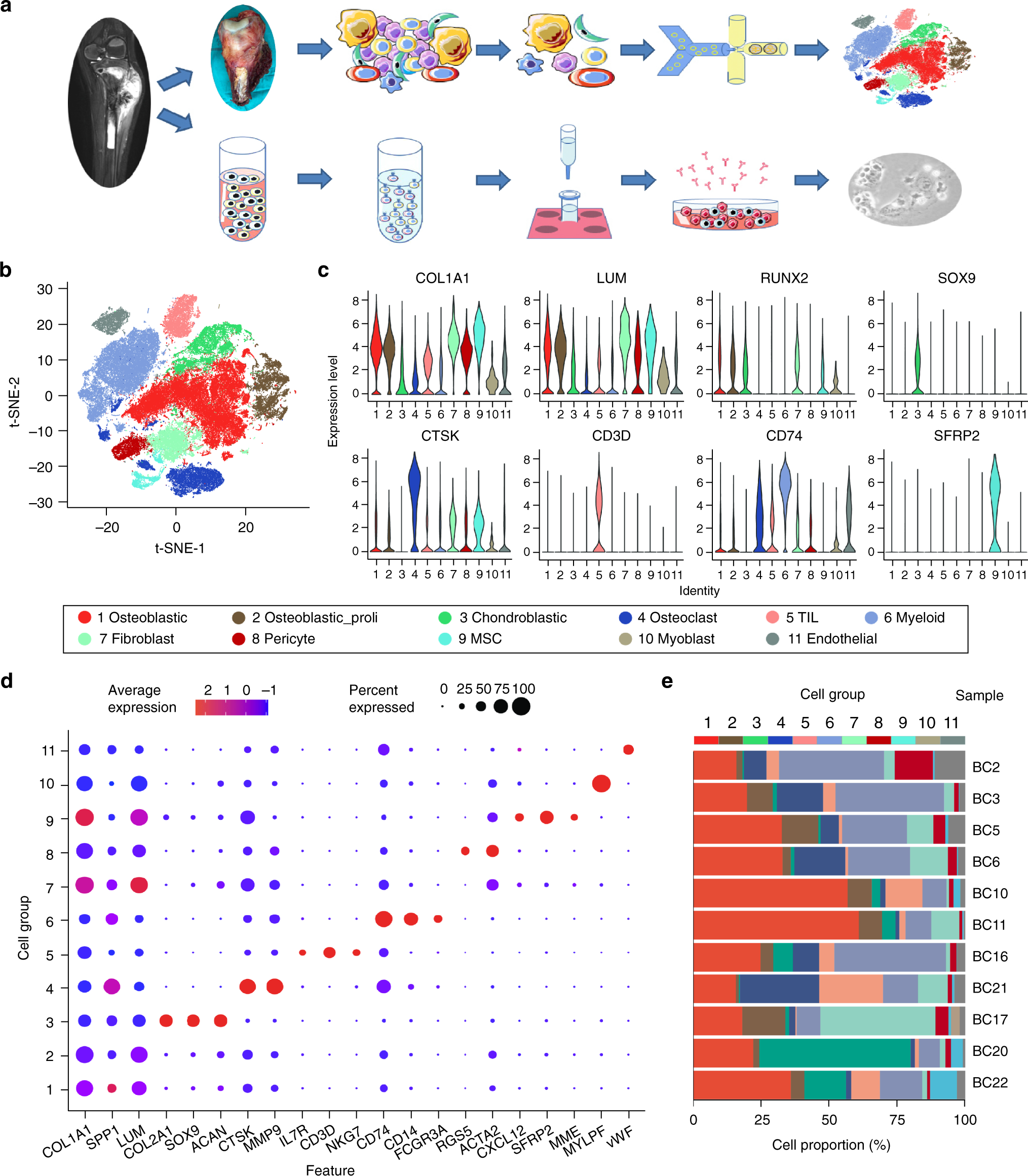 Fig. 1: Single-cell transcriptomic analysis of OS lesions.