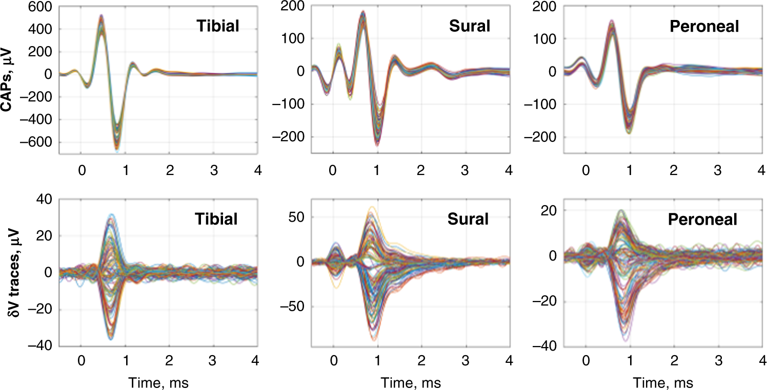 Fig. 2: Representative compound action potentials (CAPs) and δV traces.